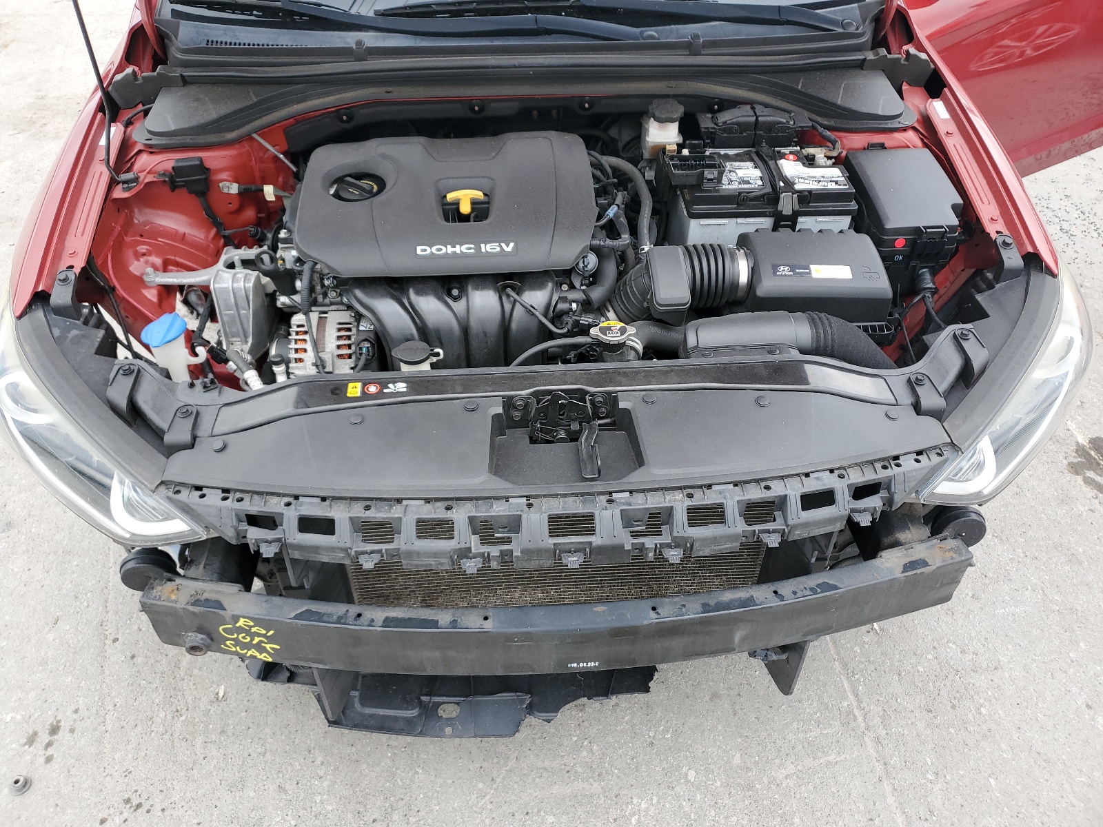 KMHD74LF0HU123902 2017 Hyundai Elantra Se