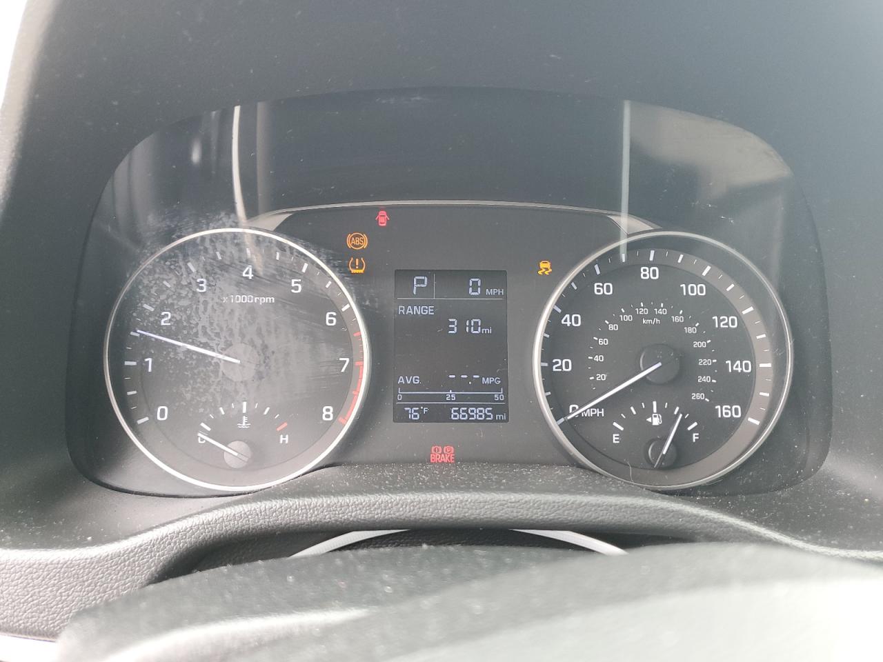 2017 Hyundai Elantra Se VIN: KMHD74LF0HU123902 Lot: 63438904