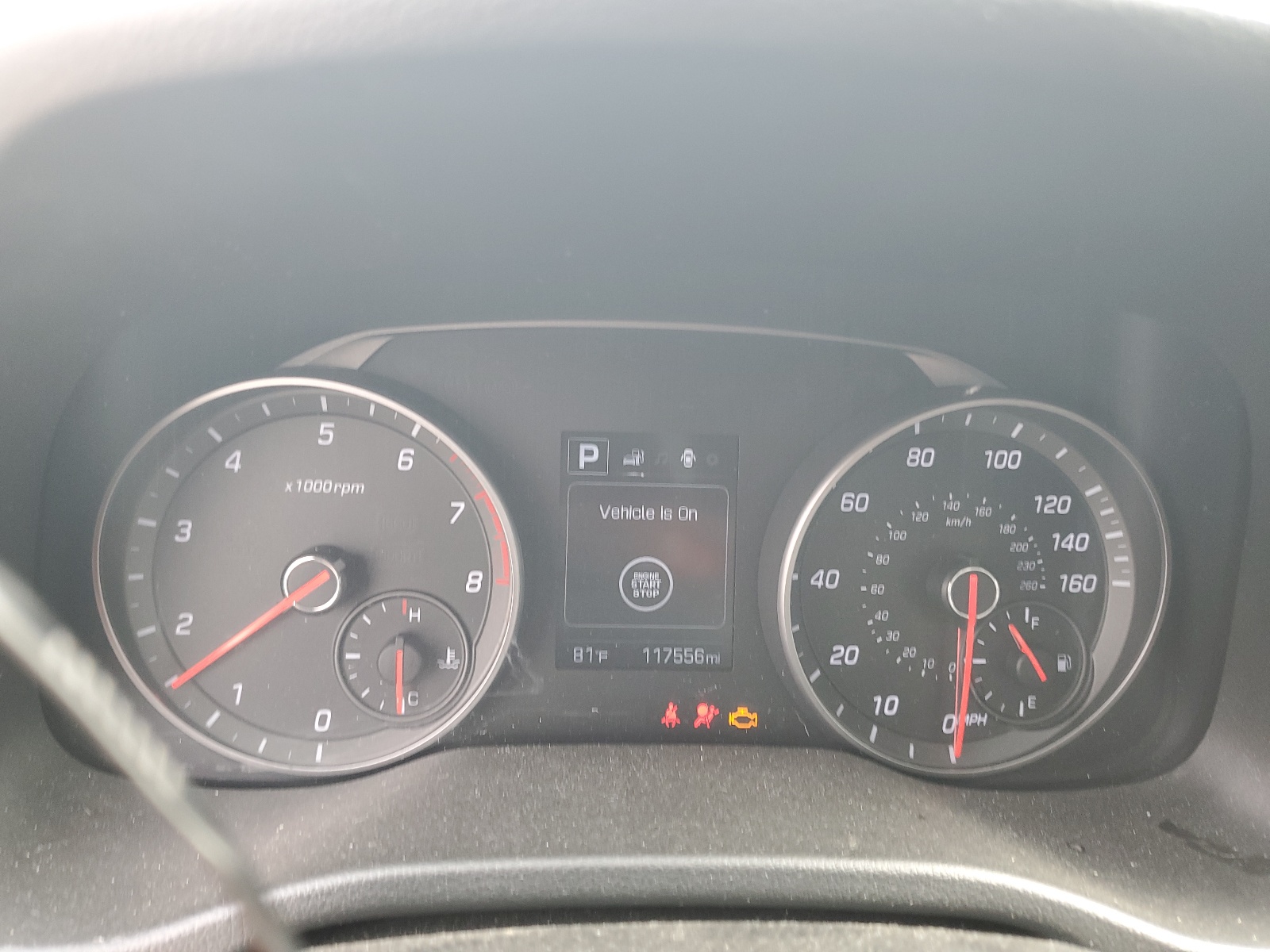 KMHD04LB0JU447908 2018 Hyundai Elantra Sport