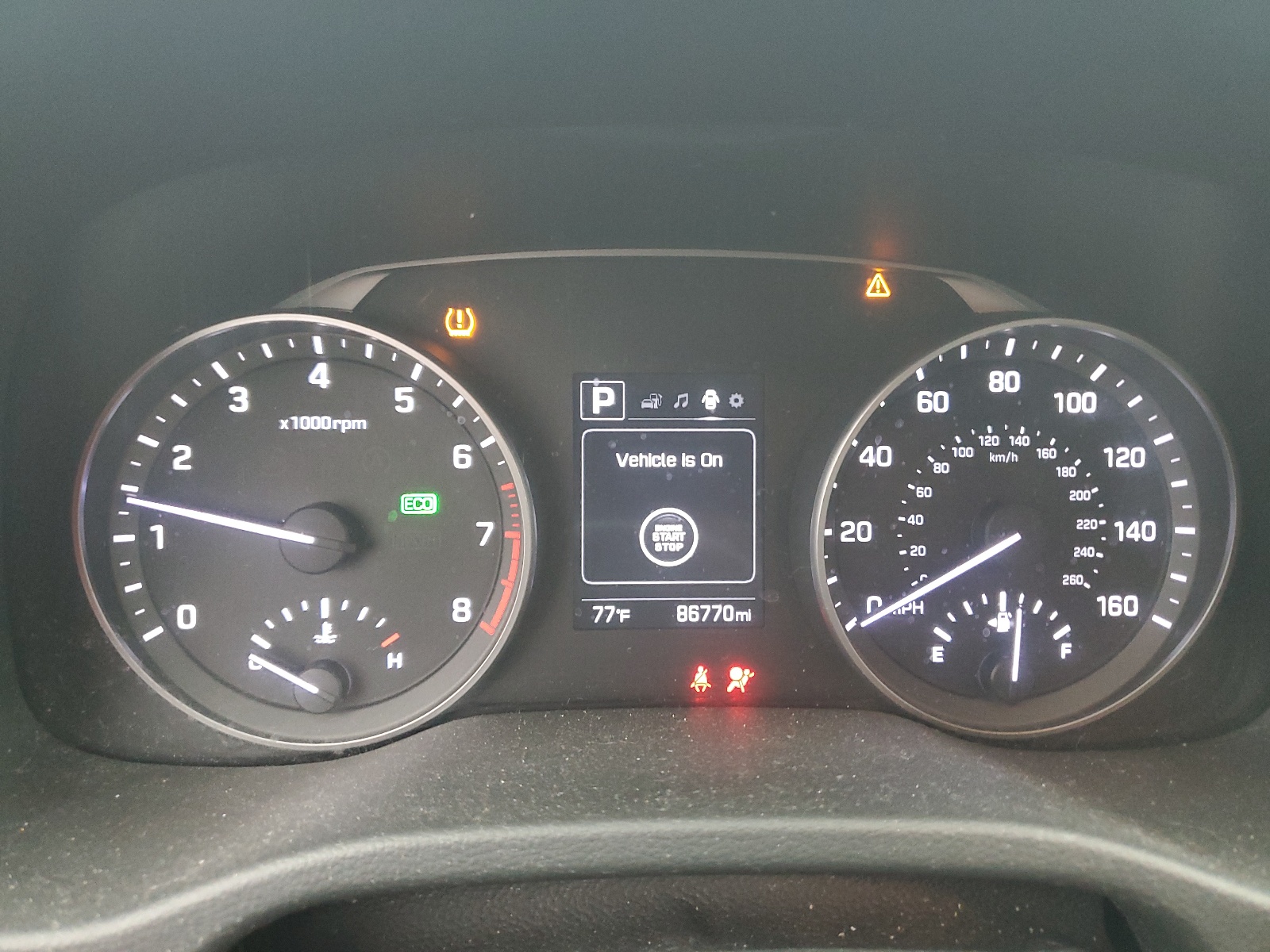 KMHD84LF6HU428110 2017 Hyundai Elantra Se