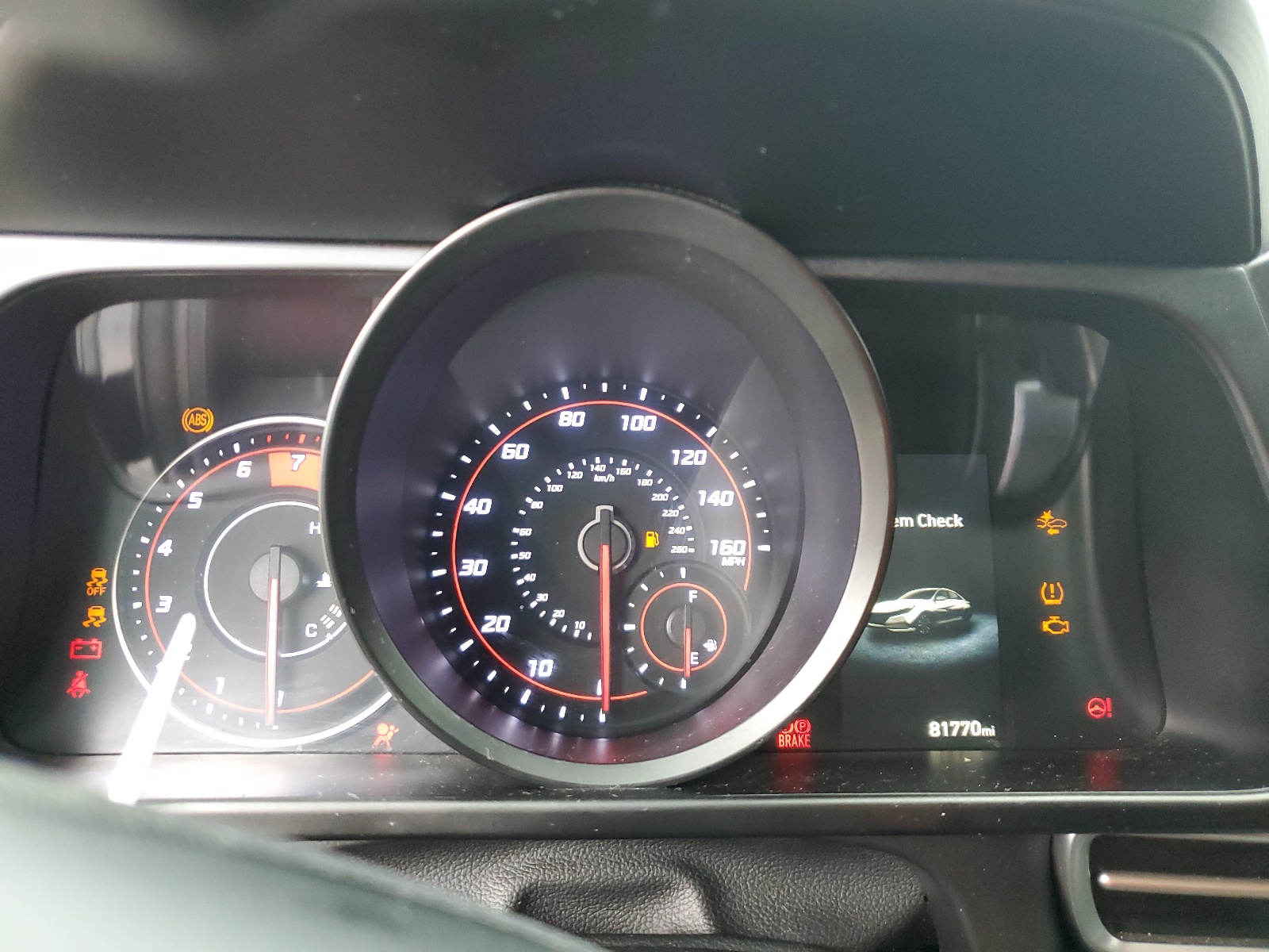 KMHLM4AGXNU361896 2022 Hyundai Elantra Sel