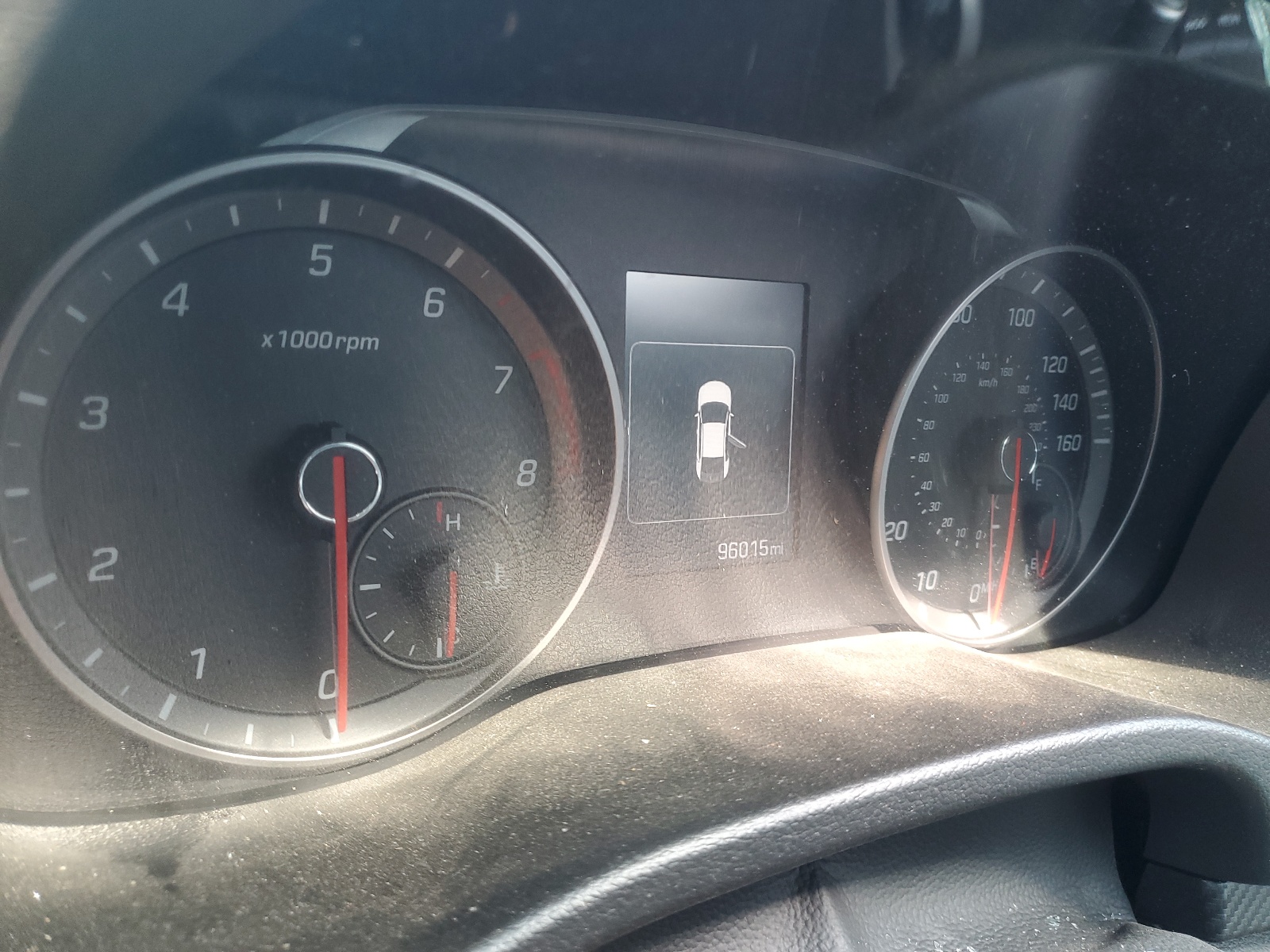 KMHD04LB6JU511787 2018 Hyundai Elantra Sport