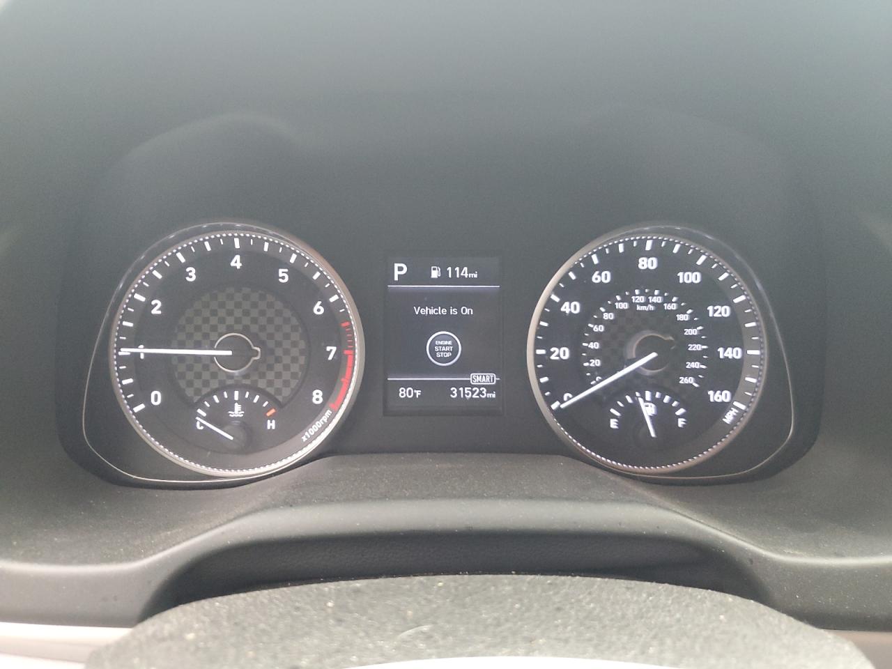 2020 Hyundai Elantra Sel VIN: 5NPD84LF1LH592176 Lot: 63627904