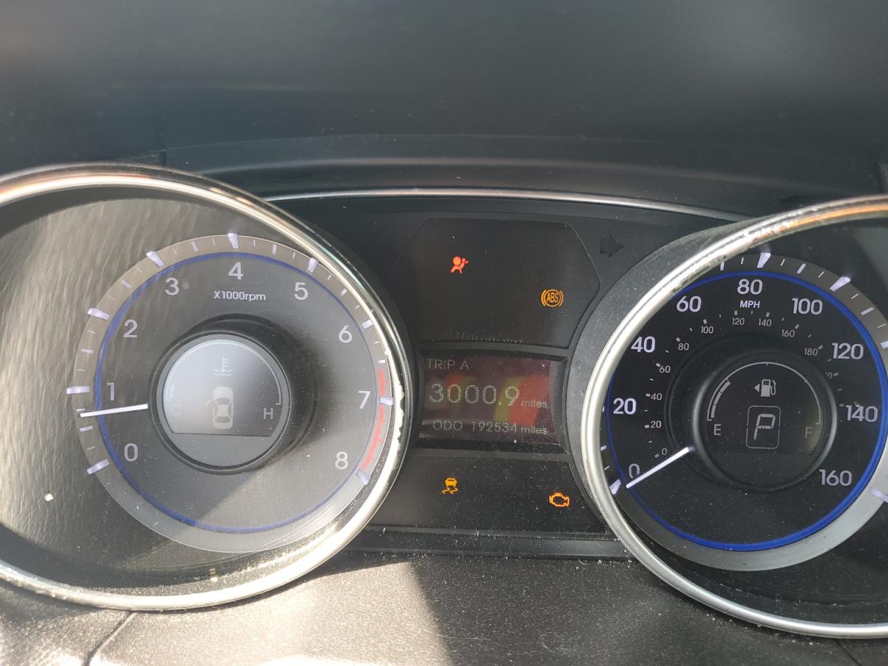 2011 Hyundai Sonata Gls VIN: 5NPEB4AC5BH094107 Lot: 62648884