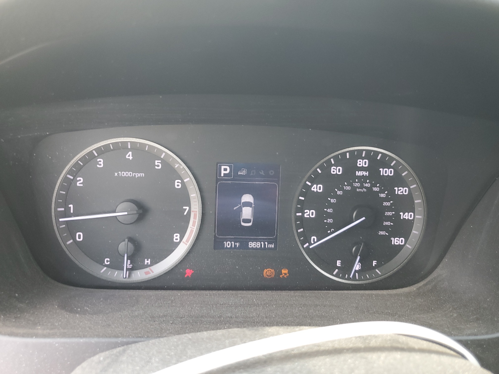 5NPE34AF5HH436798 2017 Hyundai Sonata Sport