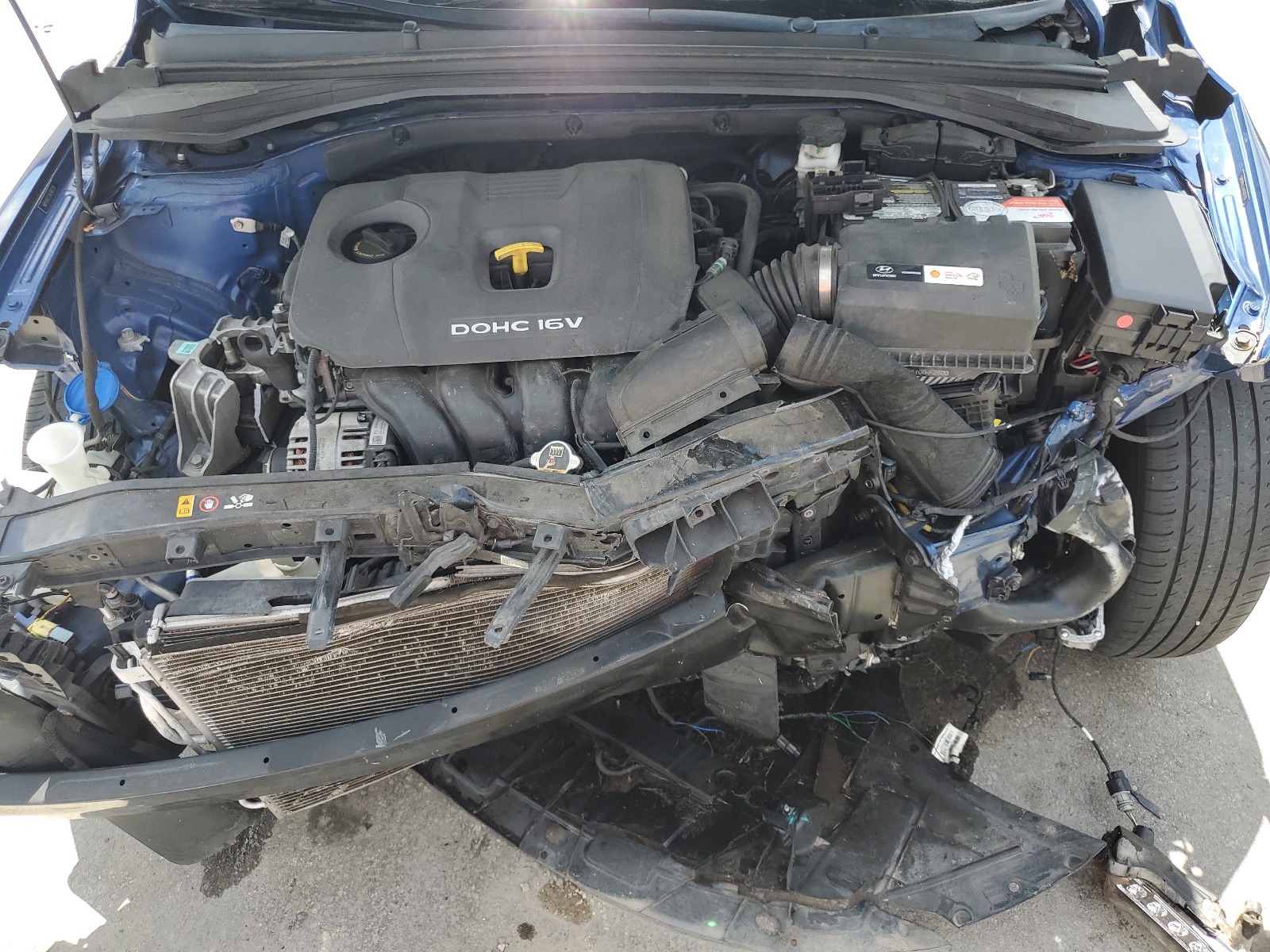 5NPD84LF2JH360778 2018 Hyundai Elantra Sel