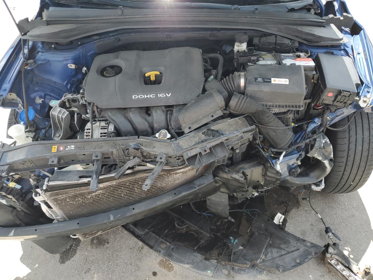 2018 Hyundai Elantra Sel VIN: 5NPD84LF2JH360778 Lot: 63815864