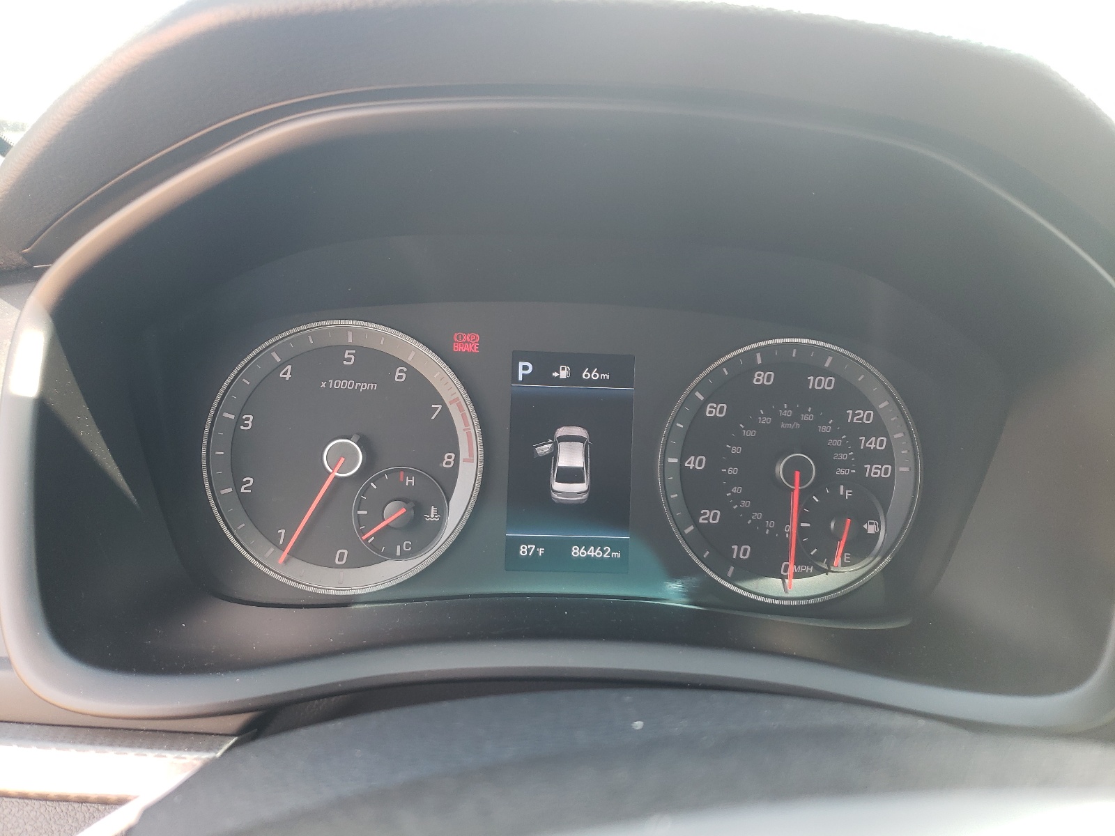 5NPE34AB9JH647232 2018 Hyundai Sonata Sport