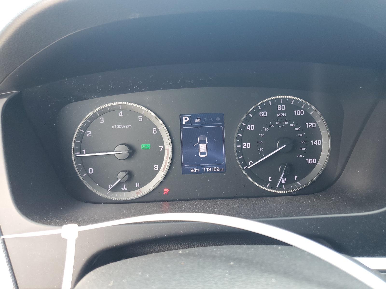 5NPE24AF8GH406034 2016 Hyundai Sonata Se