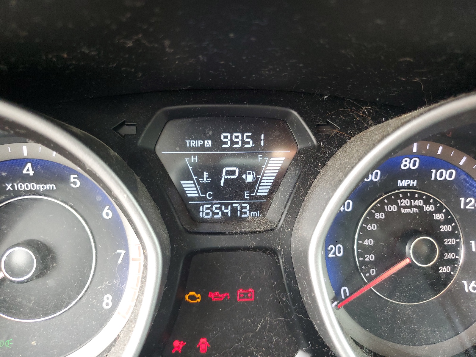 KMHDH4AE1FU225522 2015 Hyundai Elantra Se