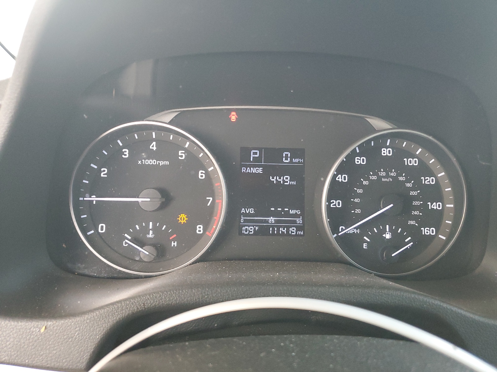 KMHD74LF2HU176486 2017 Hyundai Elantra Se