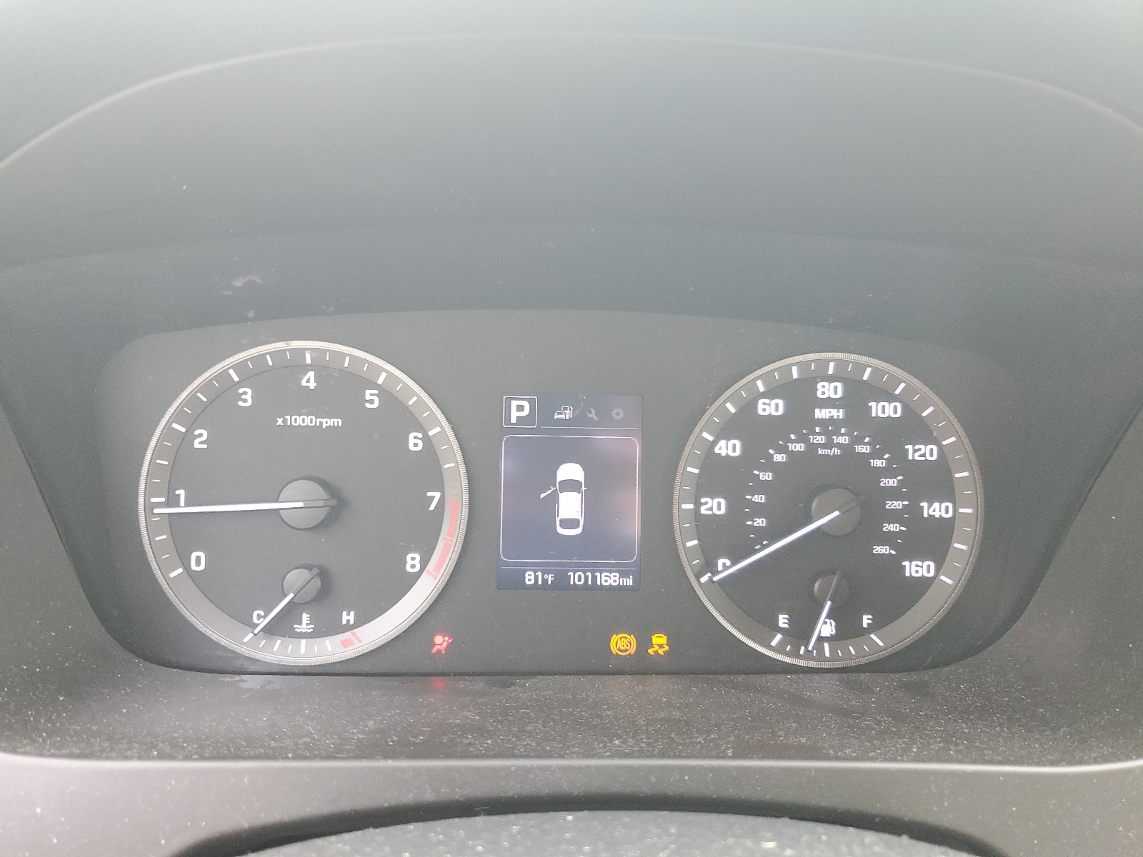 5NPE24AF0GH313315 2016 Hyundai Sonata Se