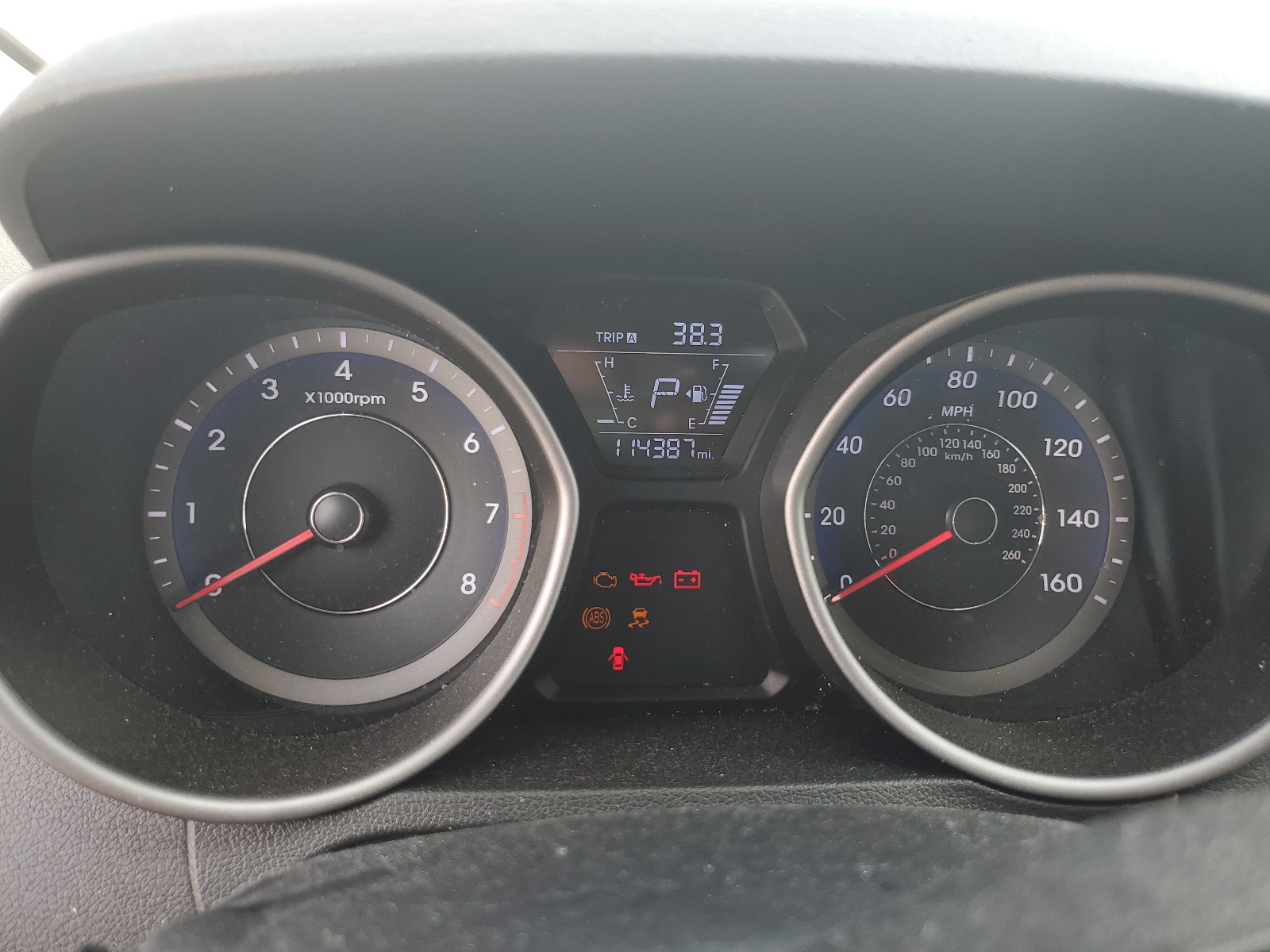 KMHDH4AE9FU429985 2015 Hyundai Elantra Se