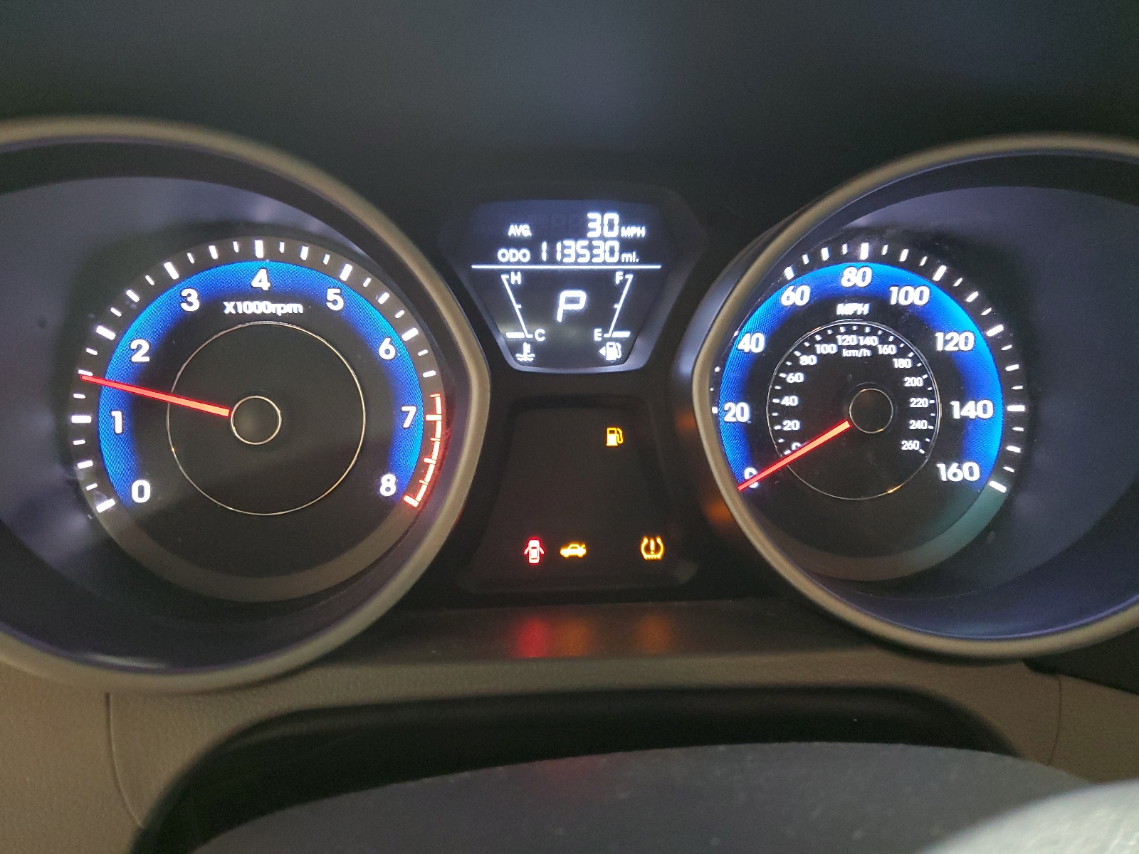 KMHDH4AE1BU140657 2011 Hyundai Elantra Gls