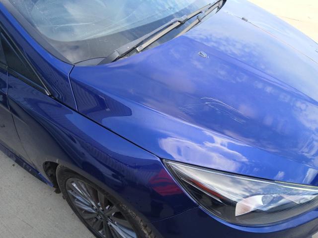 2016 FORD FOCUS ST-L