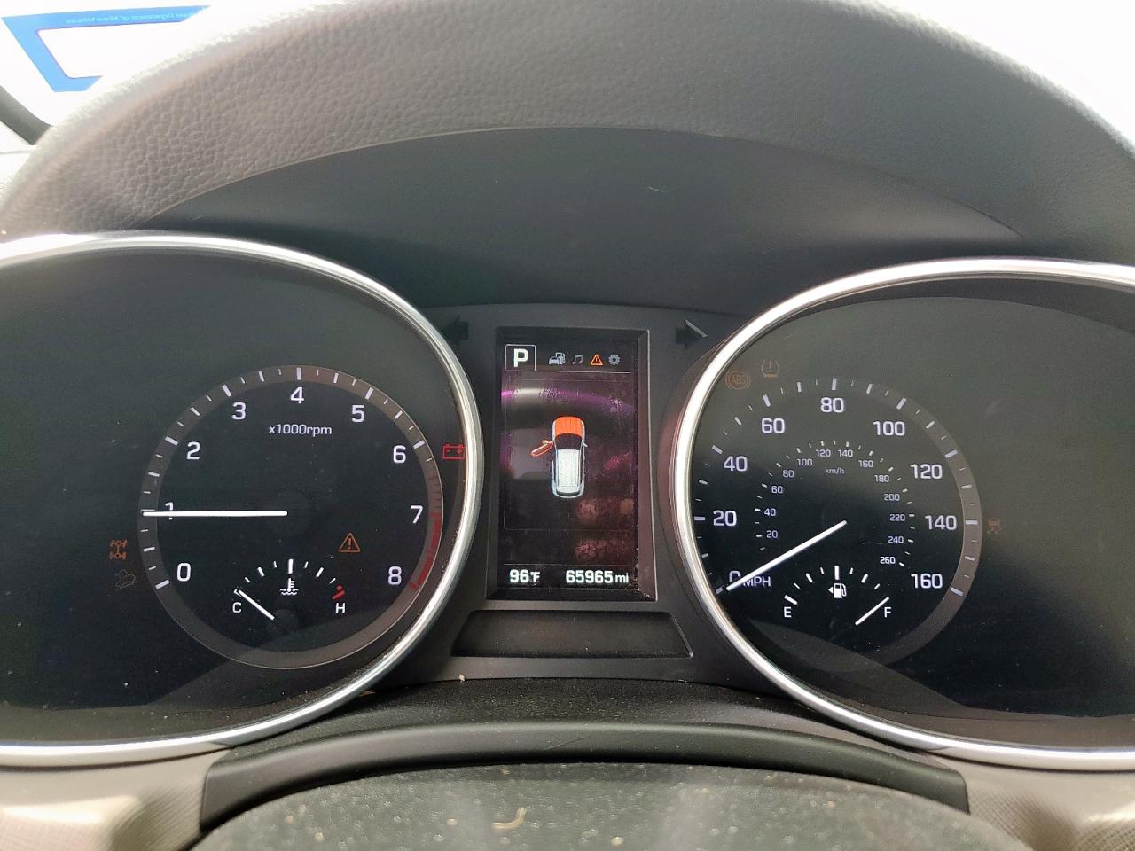 2018 Hyundai Santa Fe Sport VIN: 5XYZUDLB1JG570925 Lot: 65293555