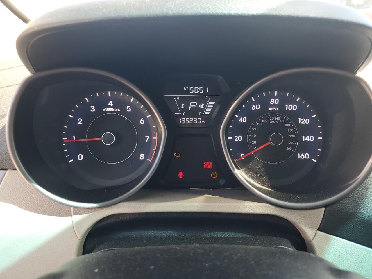 2015 Hyundai Elantra Se VIN: 5NPDH4AE0FH587548 Lot: 65337135