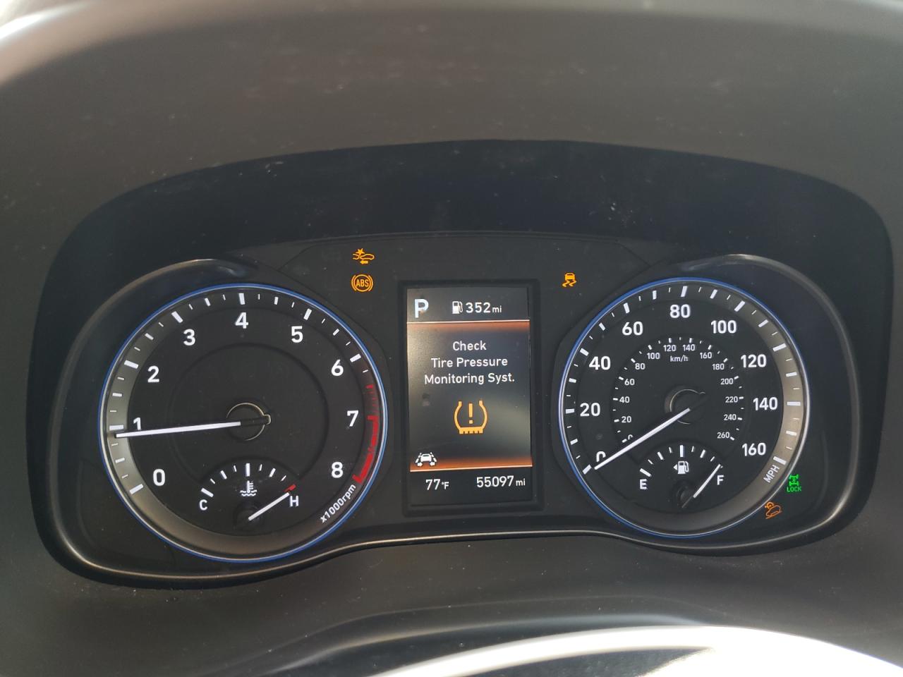 2019 Hyundai Kona Ultimate VIN: KM8K5CA52KU338416 Lot: 62708835