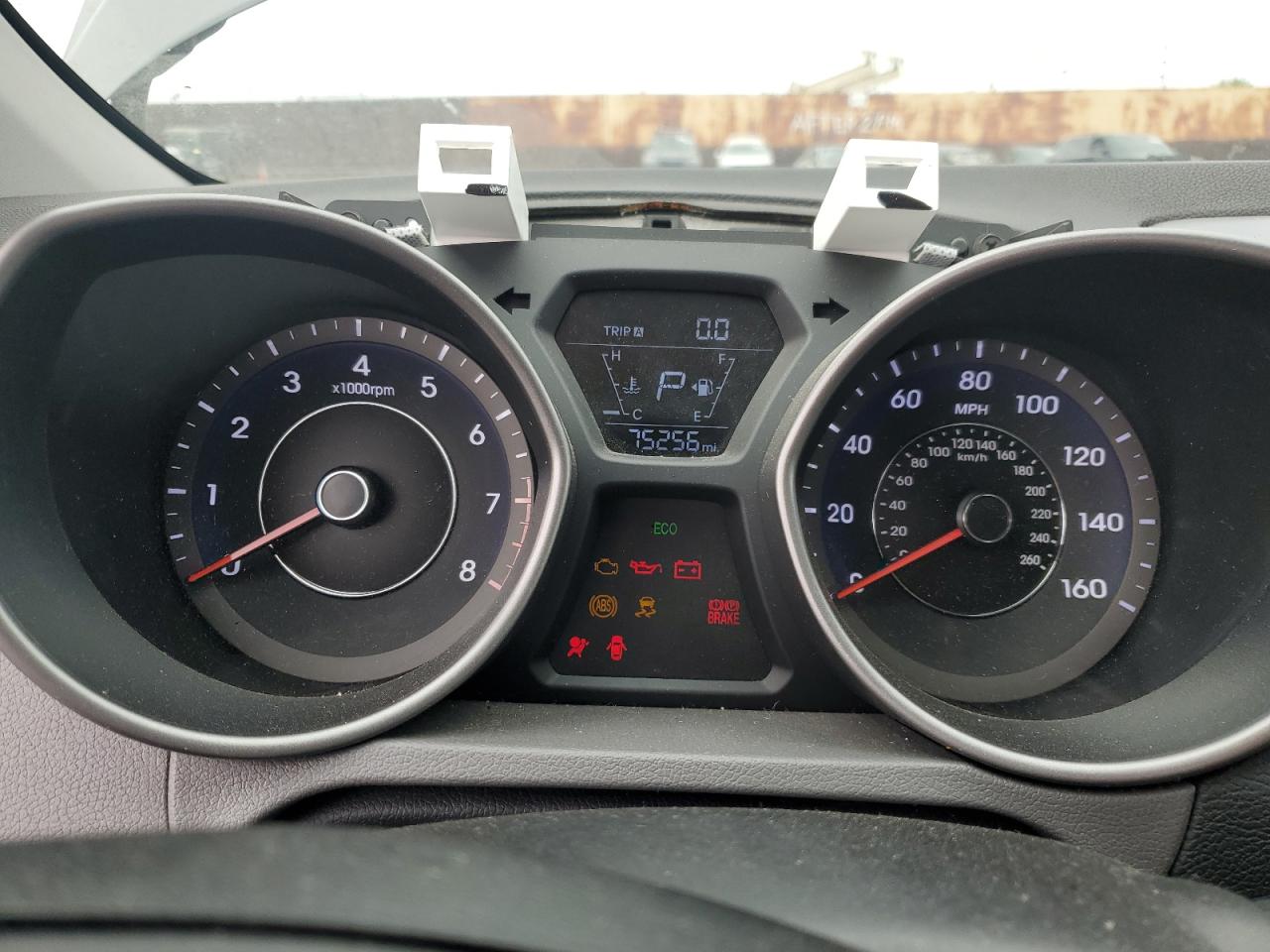 2014 Hyundai Elantra Se VIN: 5NPDH4AE7EH455420 Lot: 65204355
