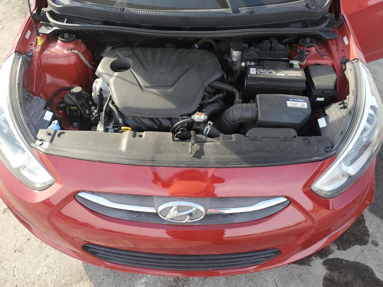 2017 Hyundai Accent Se VIN: KMHCT5AE1HU335666 Lot: 63849165