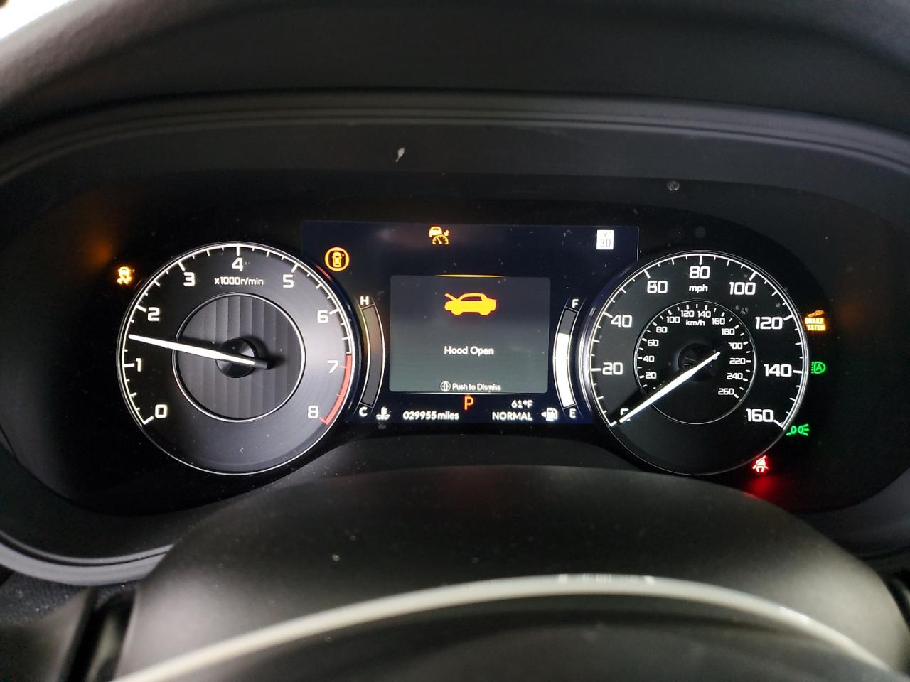 2023 Acura Tlx VIN: 19UUB5F39PA004967 Lot: 63115865