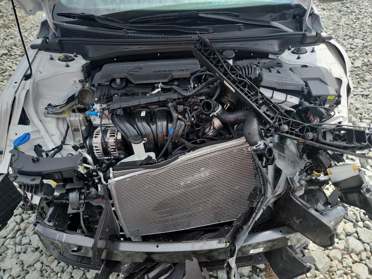 2025 Hyundai Elantra Sel Sport VIN: KMHLM4DG8SU018284 Lot: 64848495