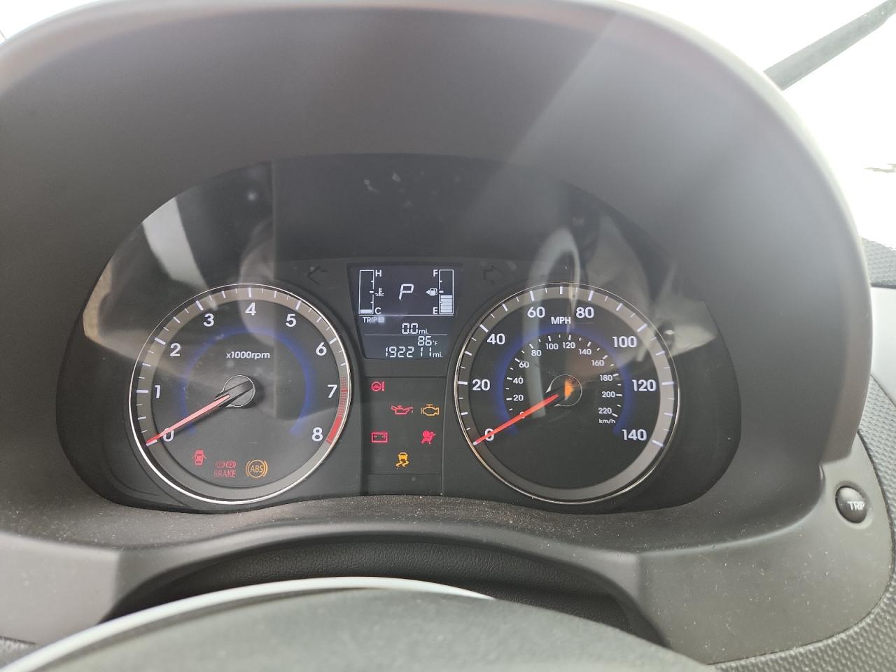 2017 Hyundai Accent Se VIN: KMHCT4AE2HU179020 Lot: 65150005