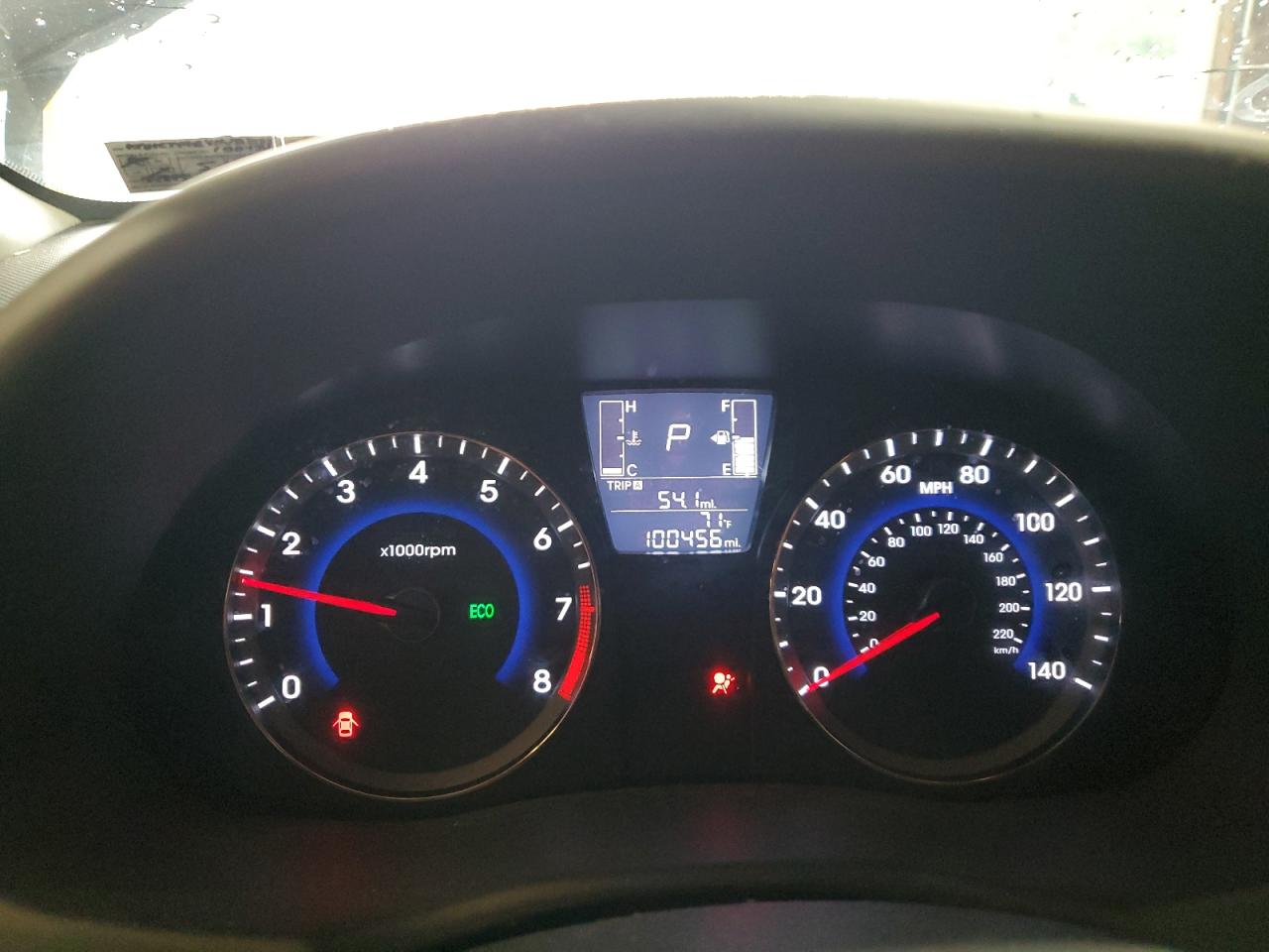 2017 Hyundai Accent Se VIN: KMHCT4AE4HU363598 Lot: 61561065