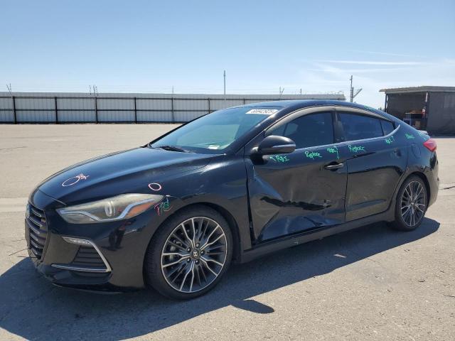  HYUNDAI ELANTRA 2018 Czarny