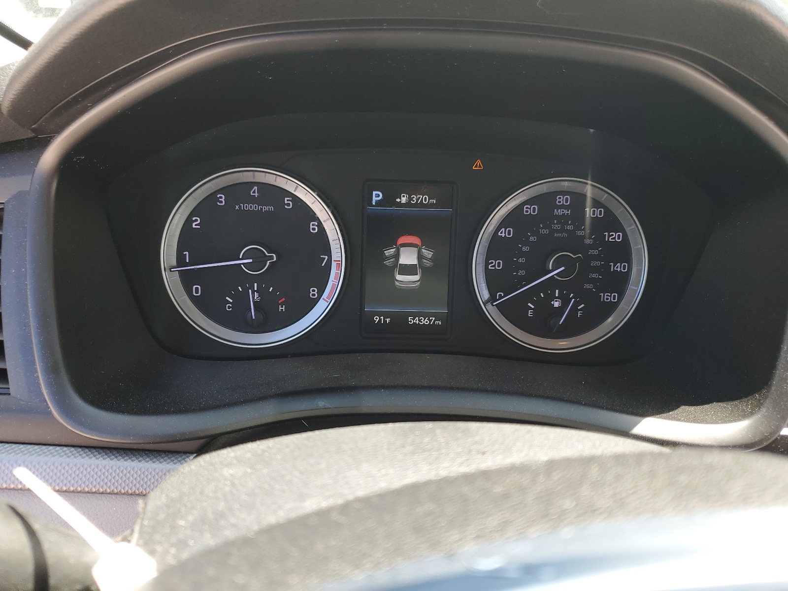 5NPE34AFXJH624397 2018 Hyundai Sonata Sport