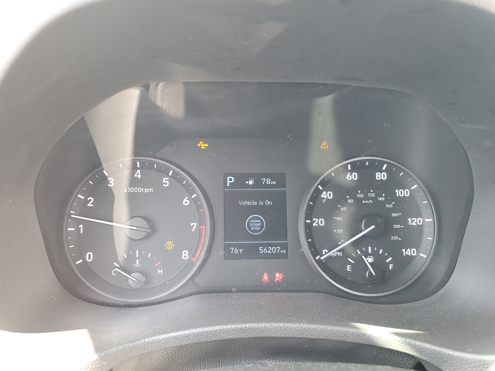 3KPC34A65ME152366 2021 Hyundai Accent Limited