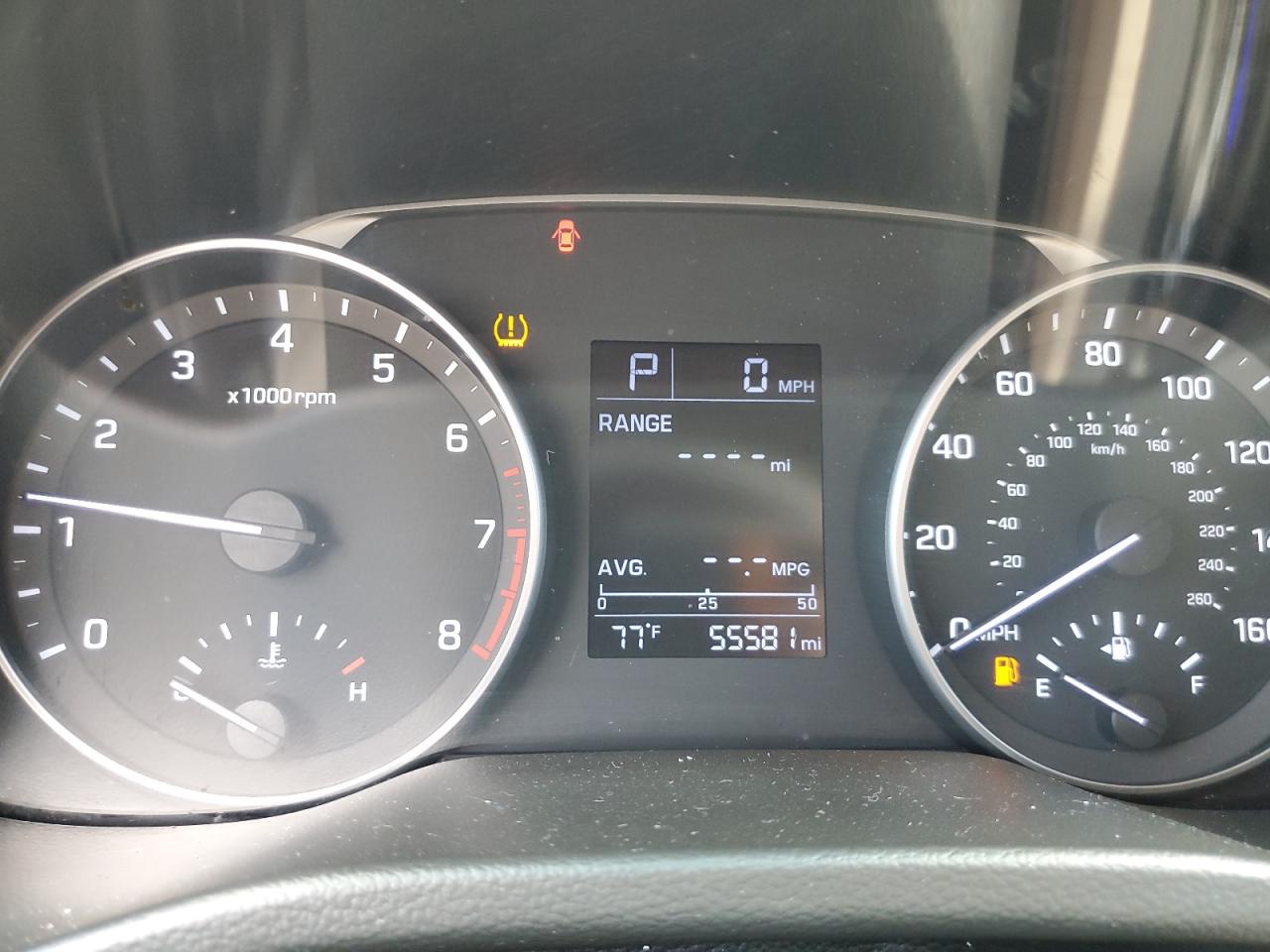 2017 Hyundai Elantra Se VIN: 5NPD84LF8HH121665 Lot: 65825534