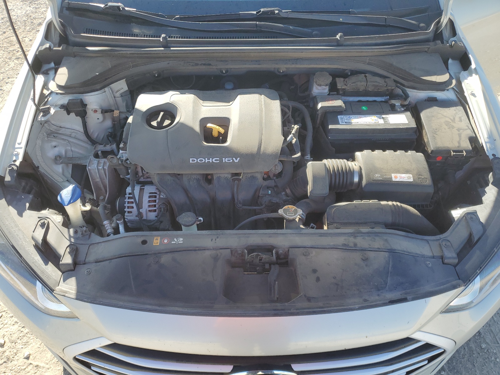 KMHD84LF0JU666394 2018 Hyundai Elantra Sel