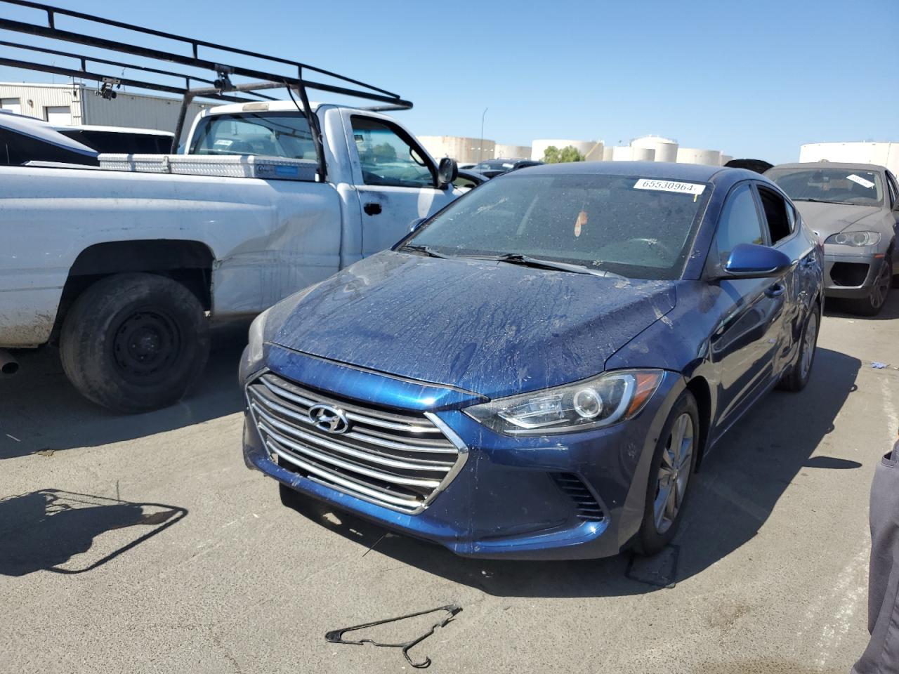 2017 Hyundai Elantra - Image 1