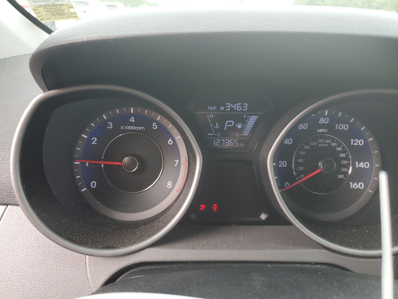 KMHDH4AE0FU359521 2015 Hyundai Elantra Se