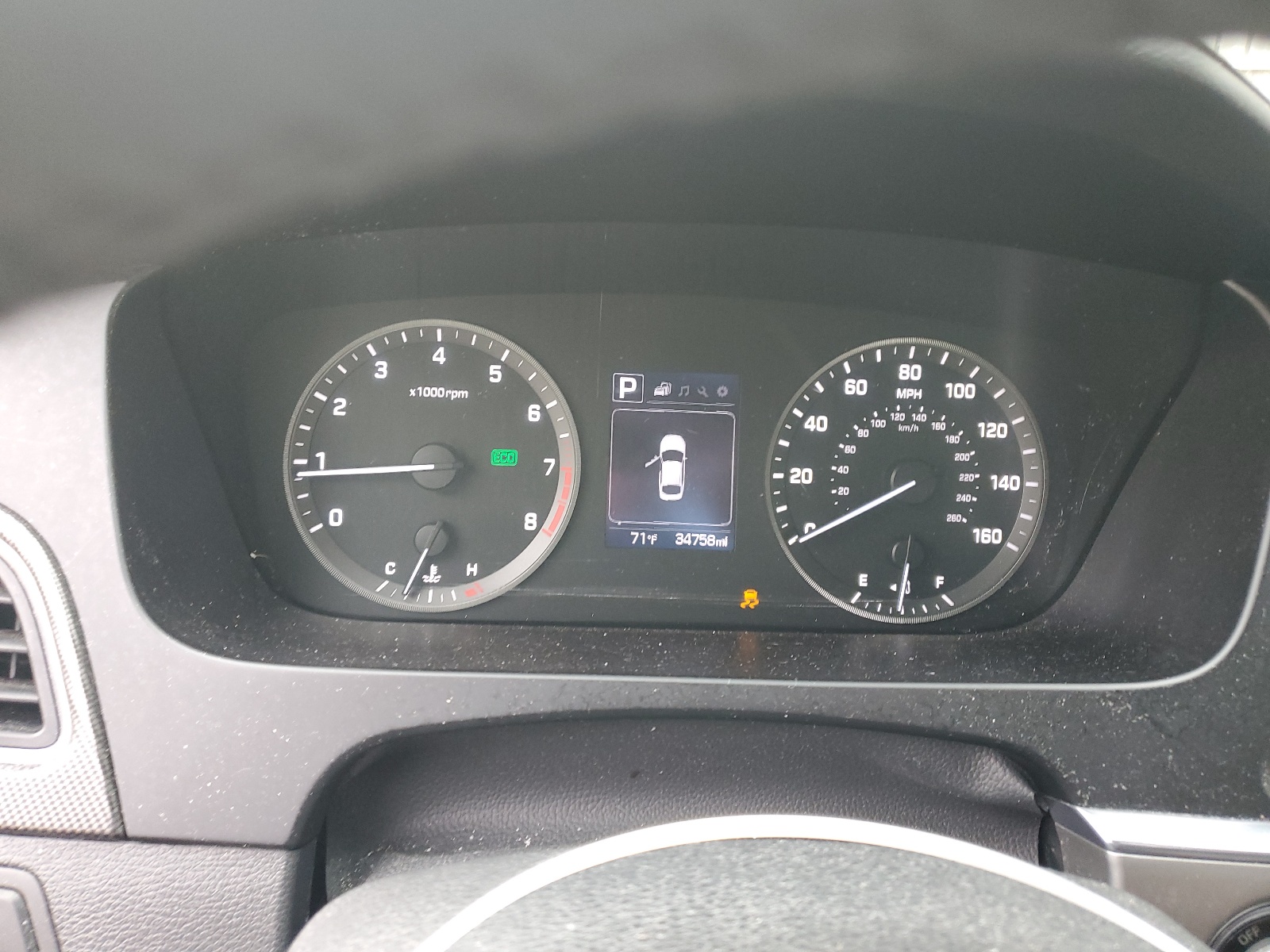 5NPE34AF9HH449148 2017 Hyundai Sonata Sport