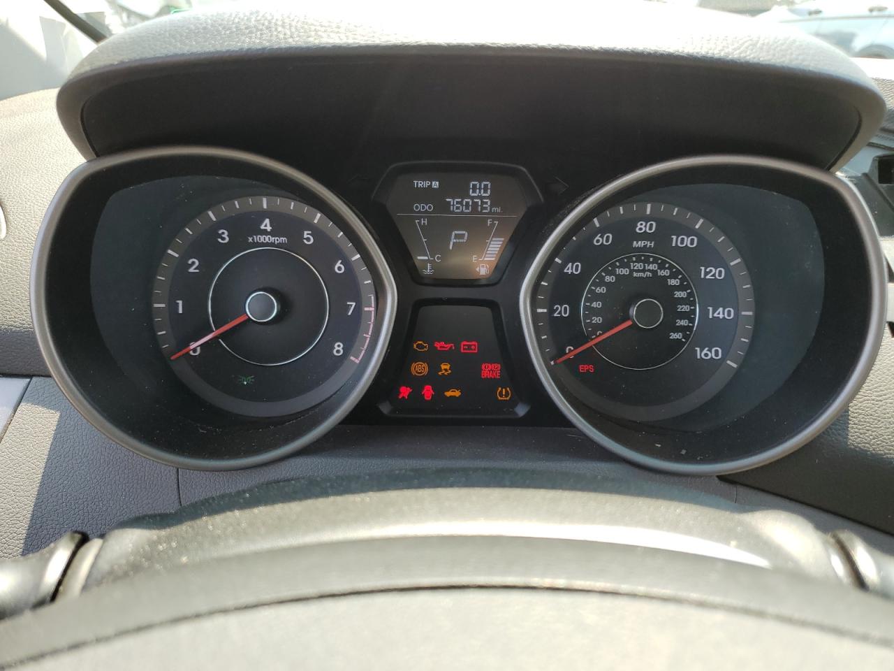 2013 Hyundai Elantra Gls VIN: 5NPDH4AE4DH194990 Lot: 65195994