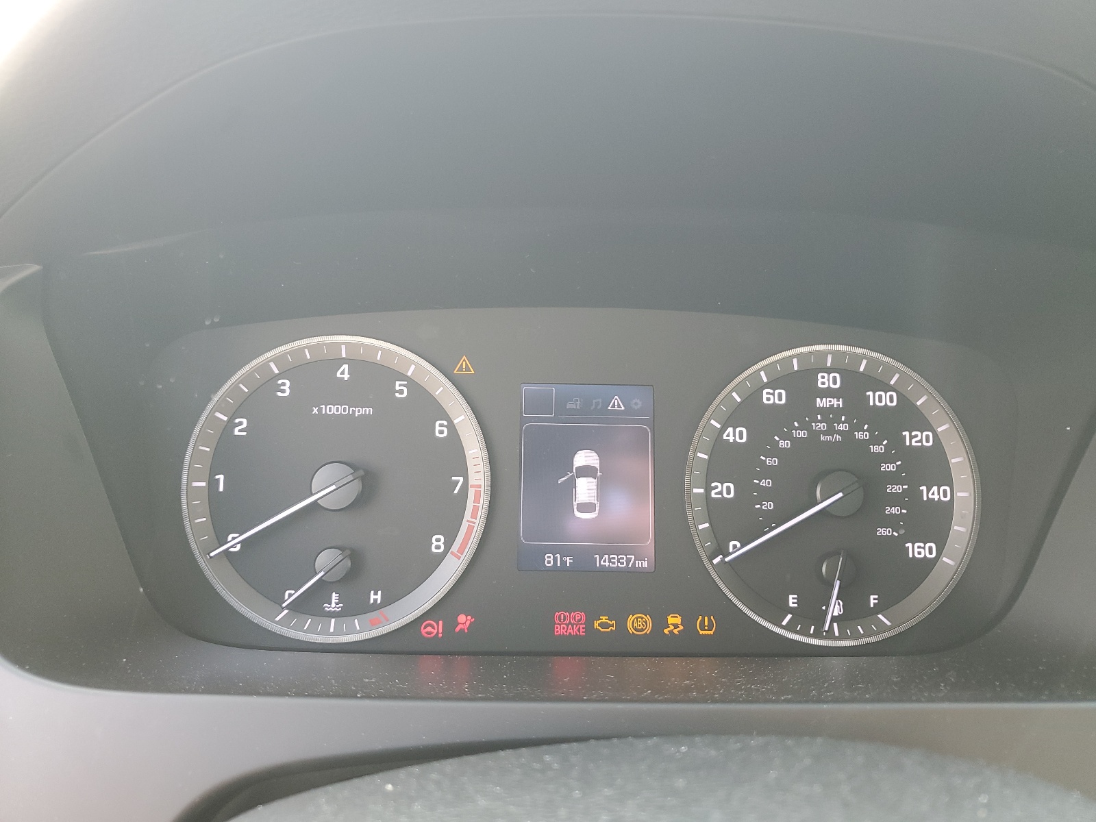 5NPE24AF6FH184320 2015 Hyundai Sonata Se