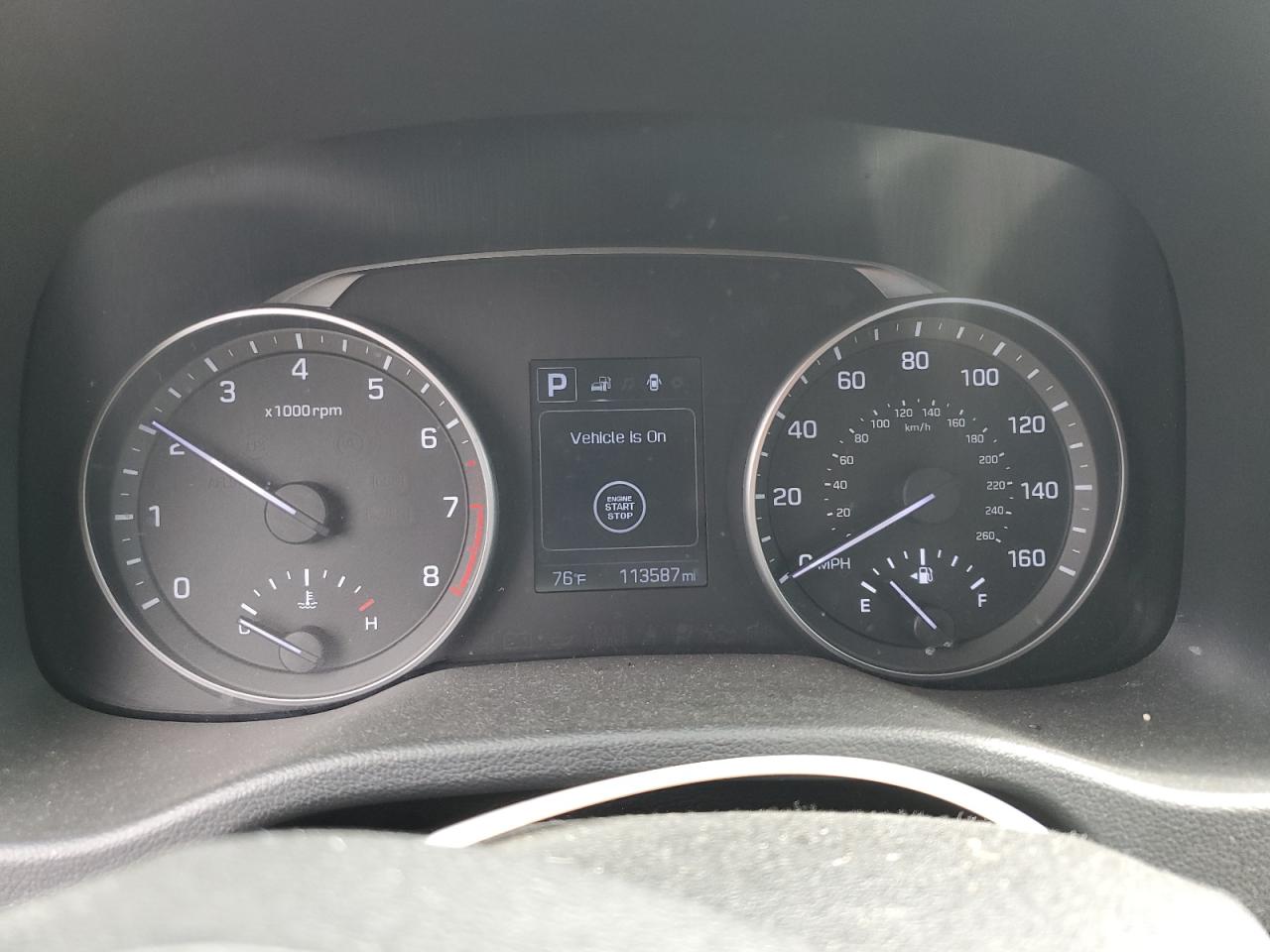 2017 Hyundai Elantra Se VIN: KMHD84LFXHU240805 Lot: 48837294