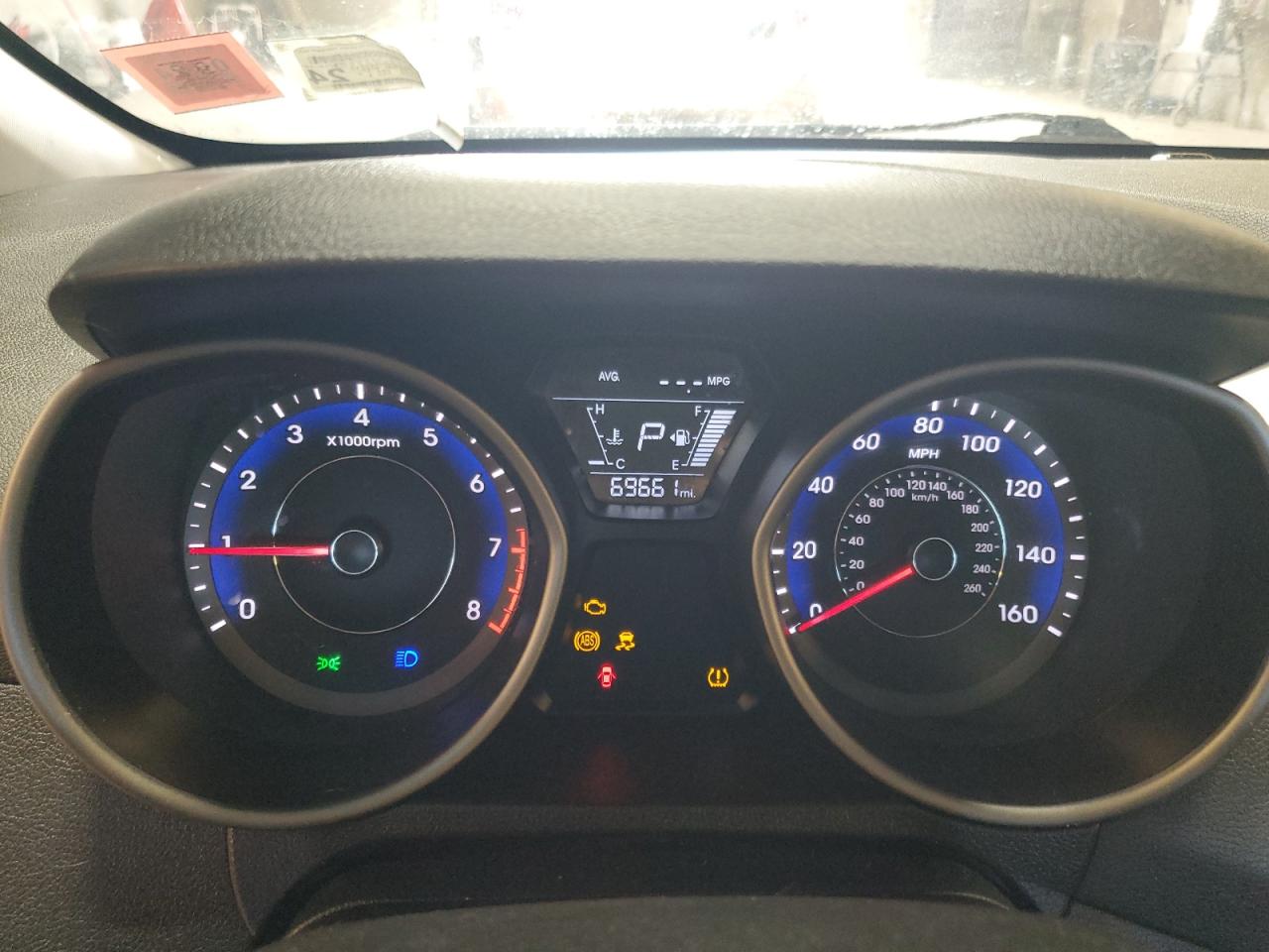 KMHDH4AE3GU522843 2016 Hyundai Elantra Se