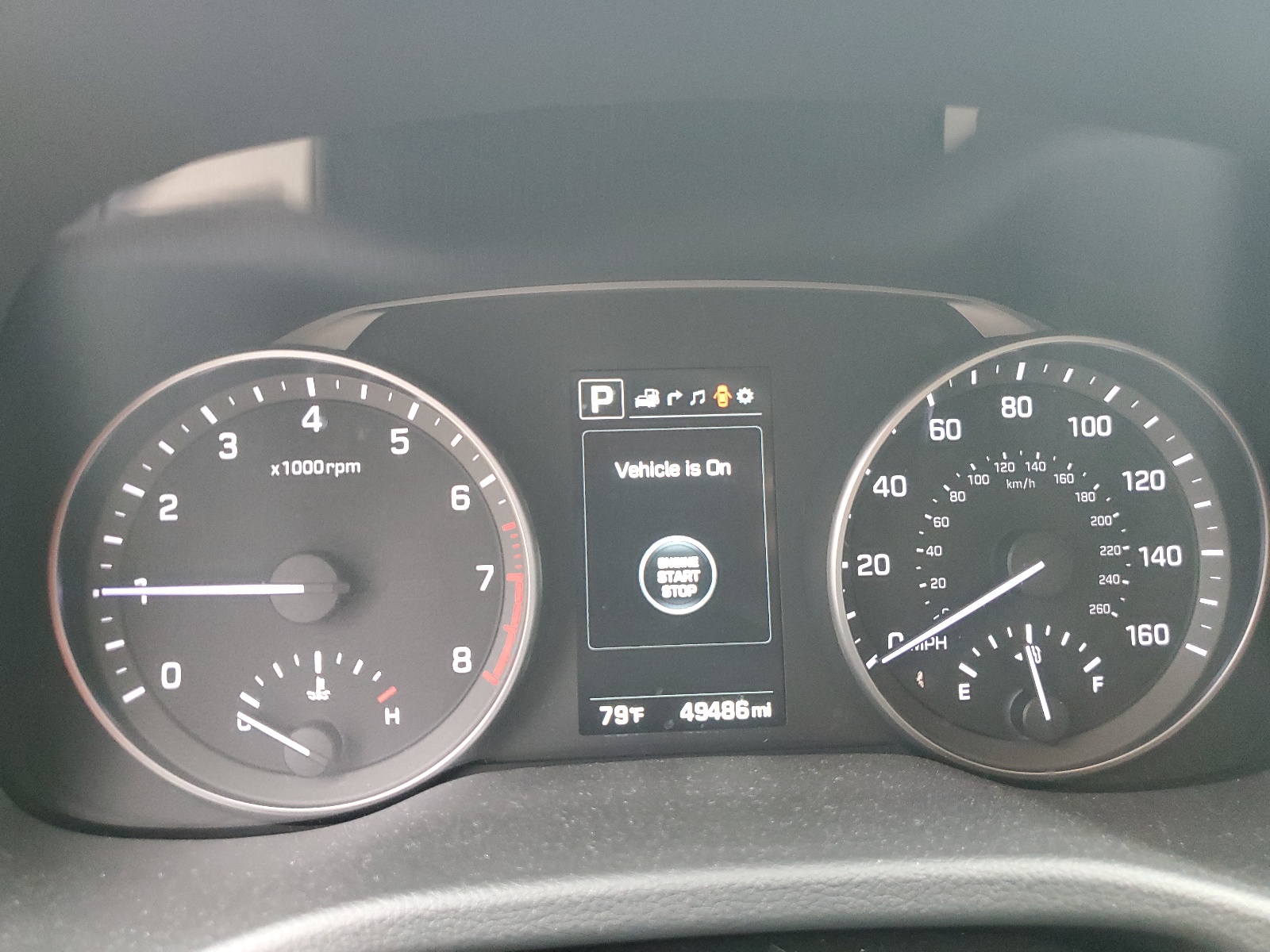 KMHD84LFXHU164986 2017 Hyundai Elantra Se