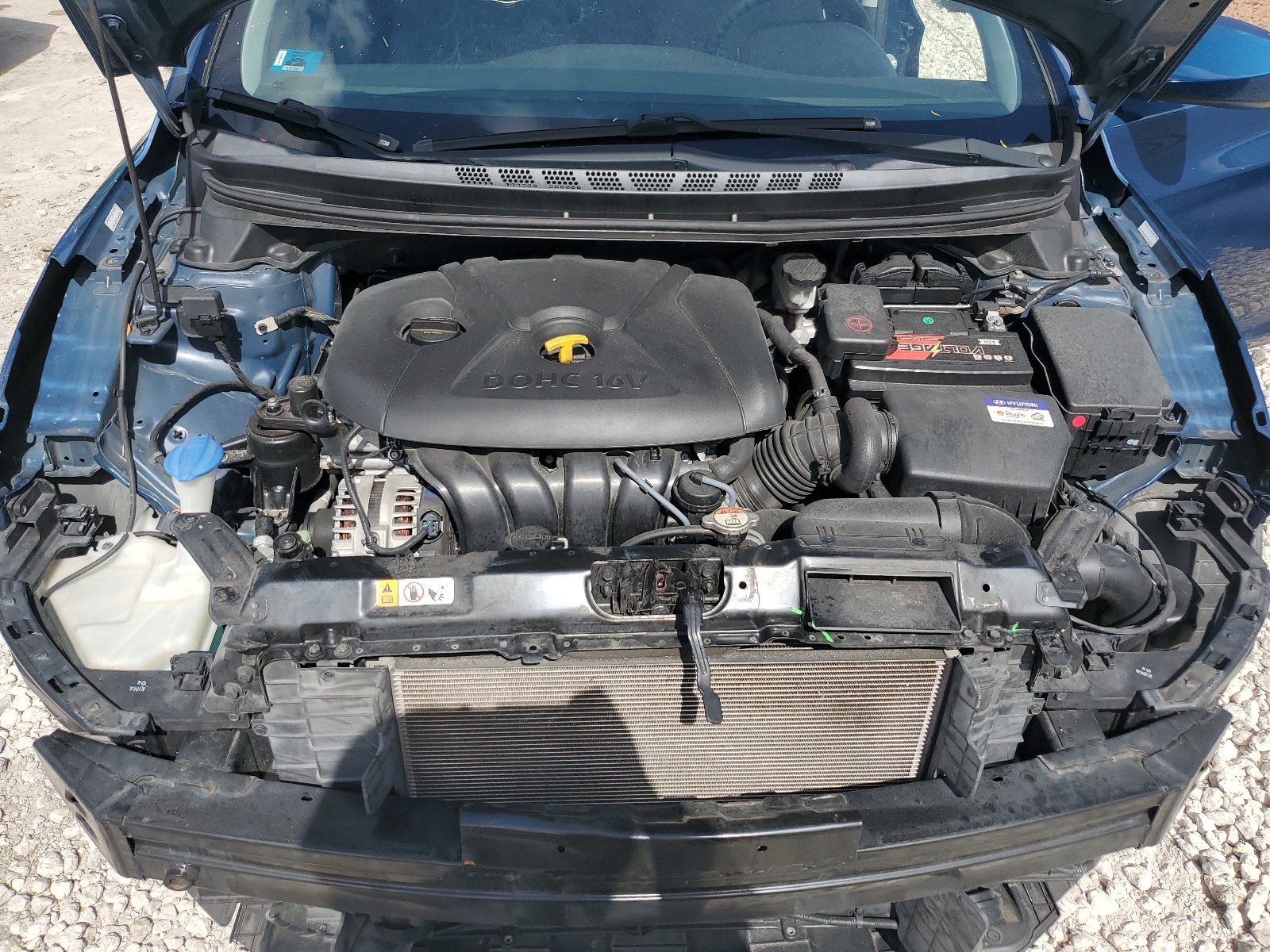 KMHDH4AE0GU649209 2016 Hyundai Elantra Se