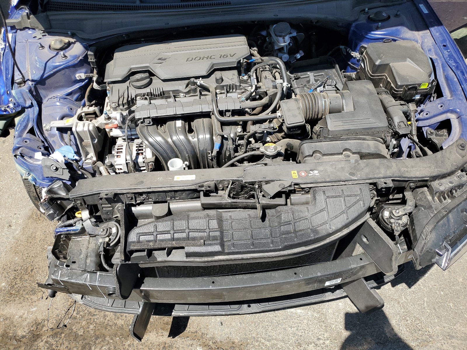 KMHLM4DG7RU672087 2024 Hyundai Elantra Sel