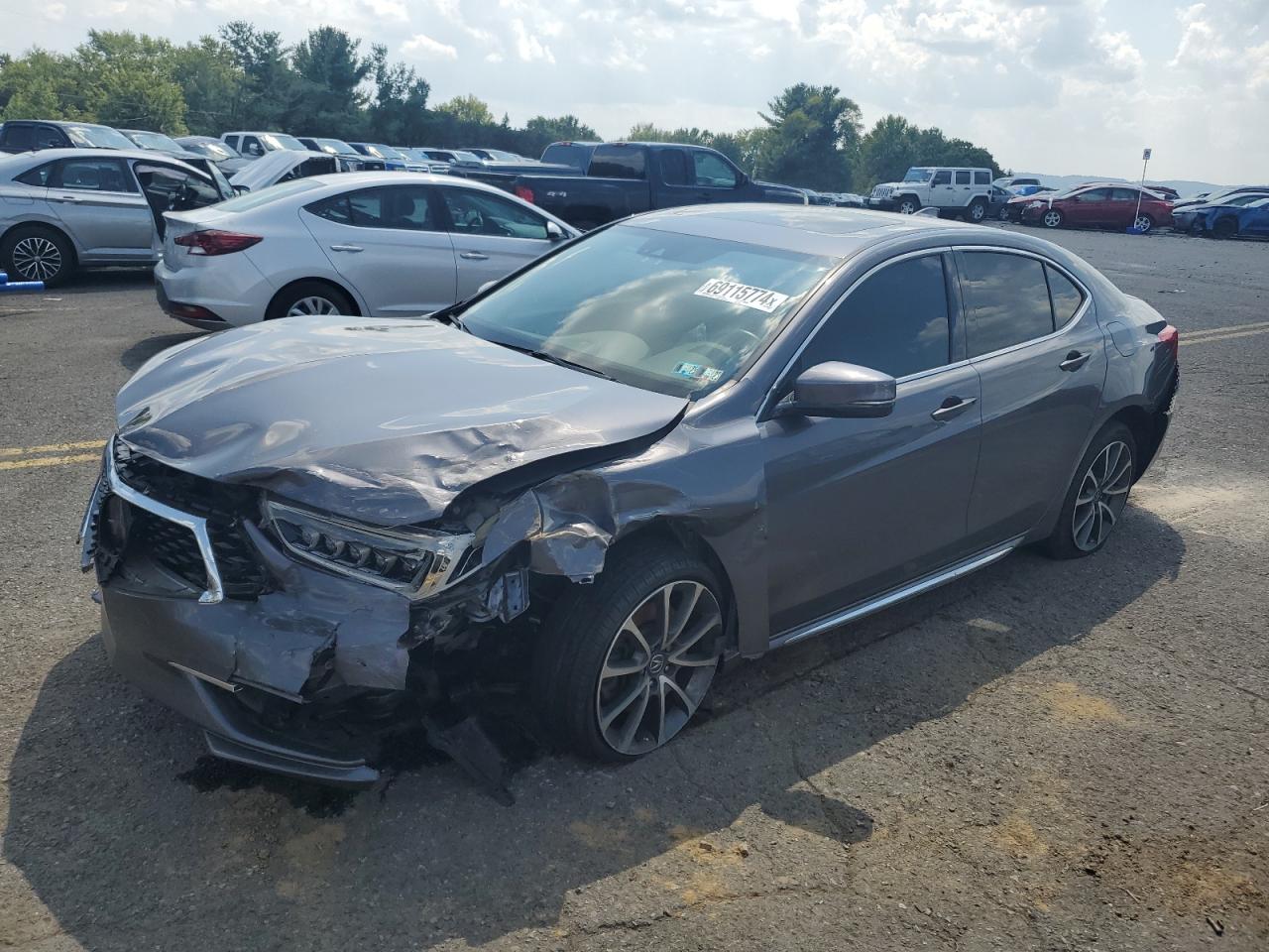 2018 Acura TLX - Image 1