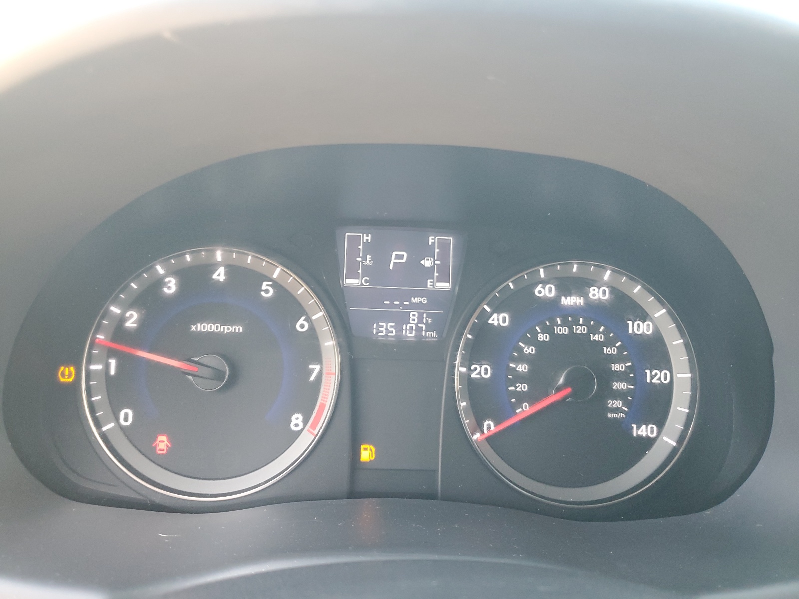 KMHCT4AE3GU979176 2016 Hyundai Accent Se