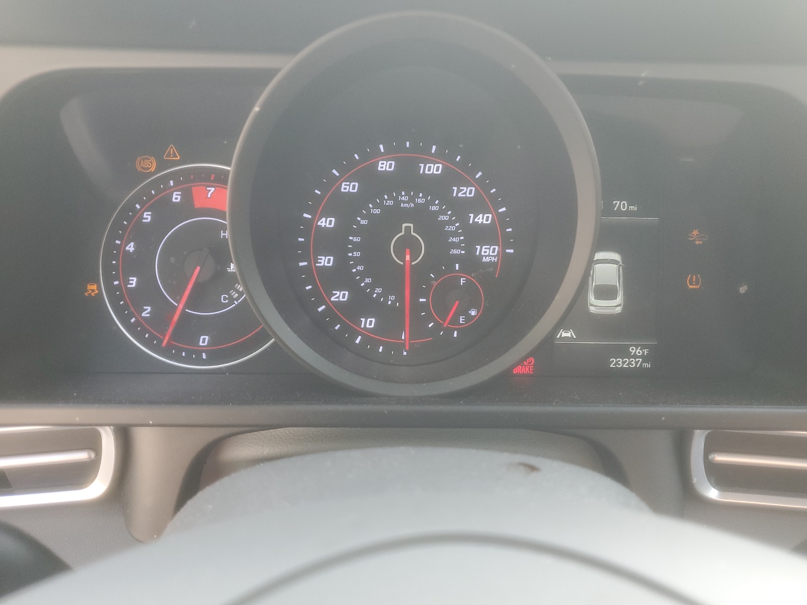 KMHLM4AG3NU218062 2022 Hyundai Elantra Sel