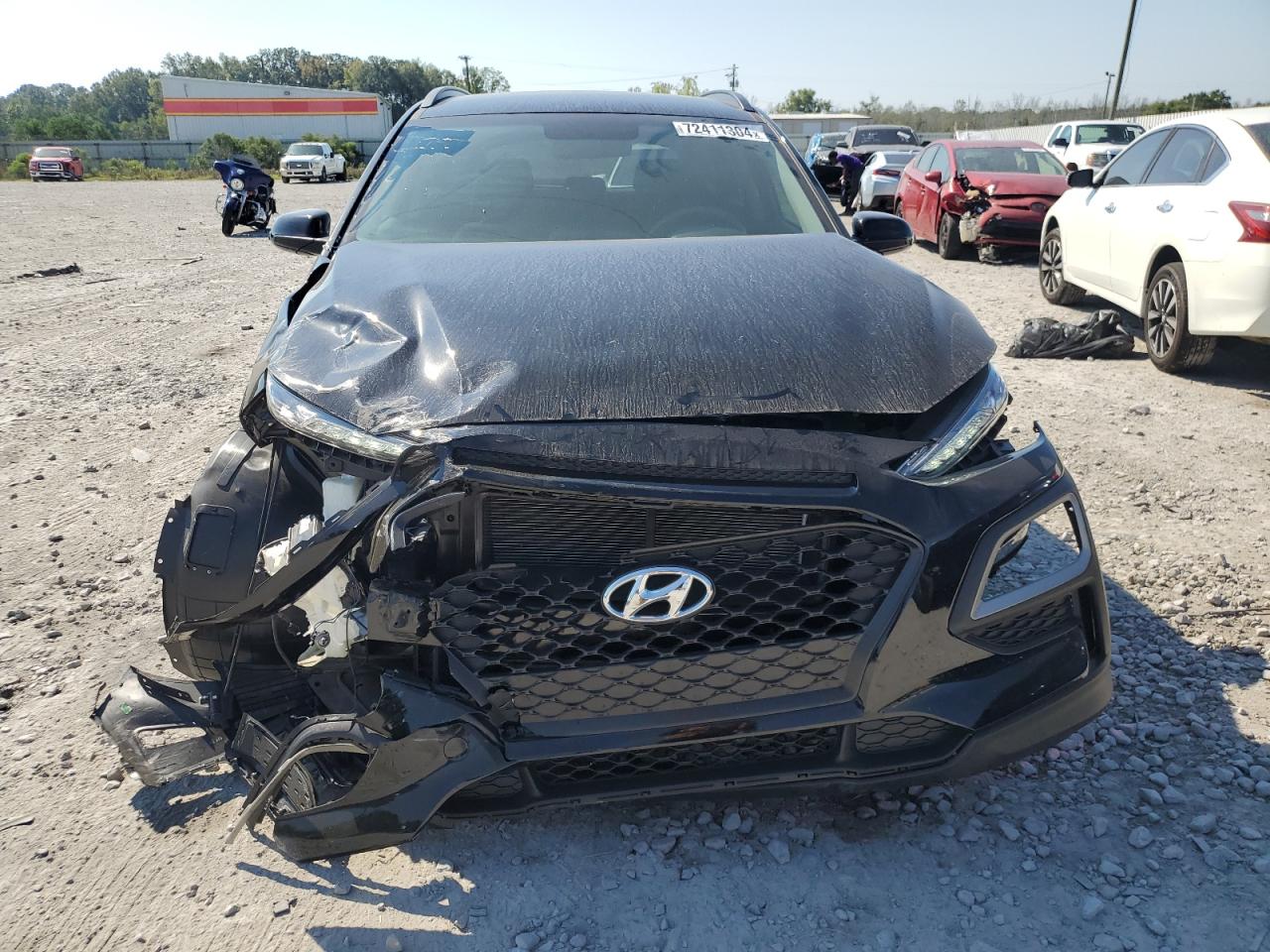 2018 Hyundai Kona - Image 5