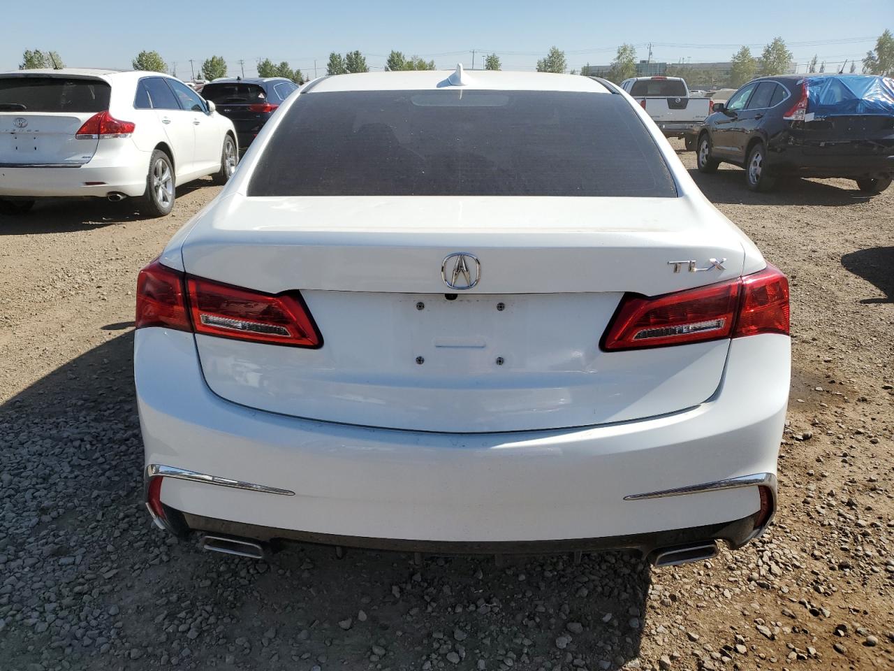 19UUB1F52JA800719 2018 Acura Tlx Tech