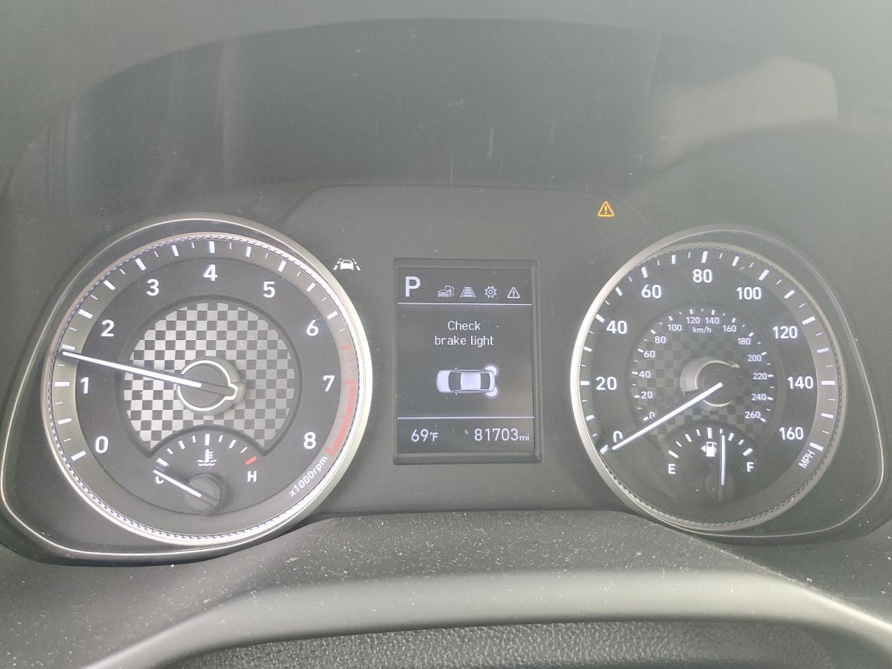 2020 Hyundai Elantra - Image 9
