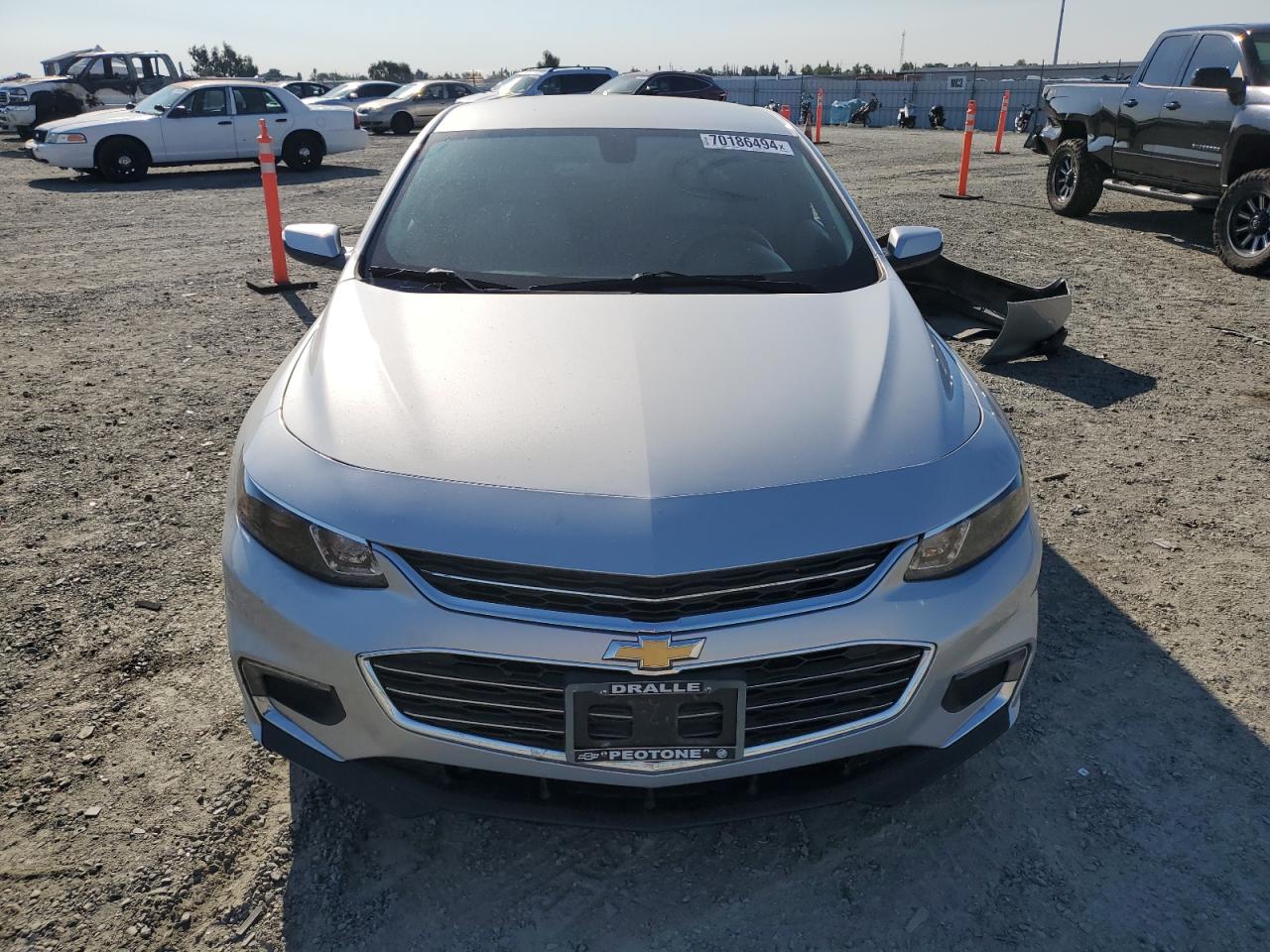 2017 Chevrolet Malibu - Image 5